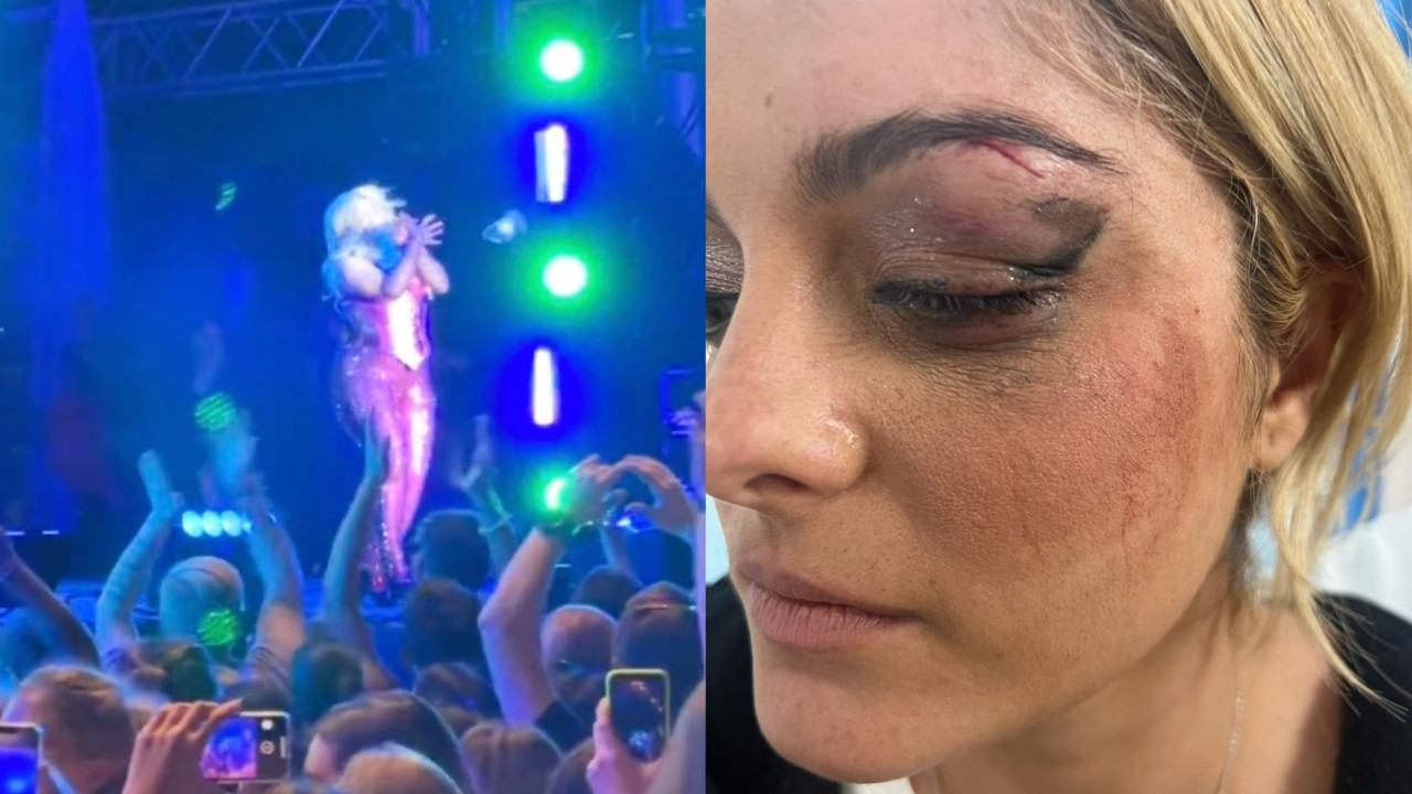 Cantora Bebe Rexha atingida no rosto por telemóvel durante atuação