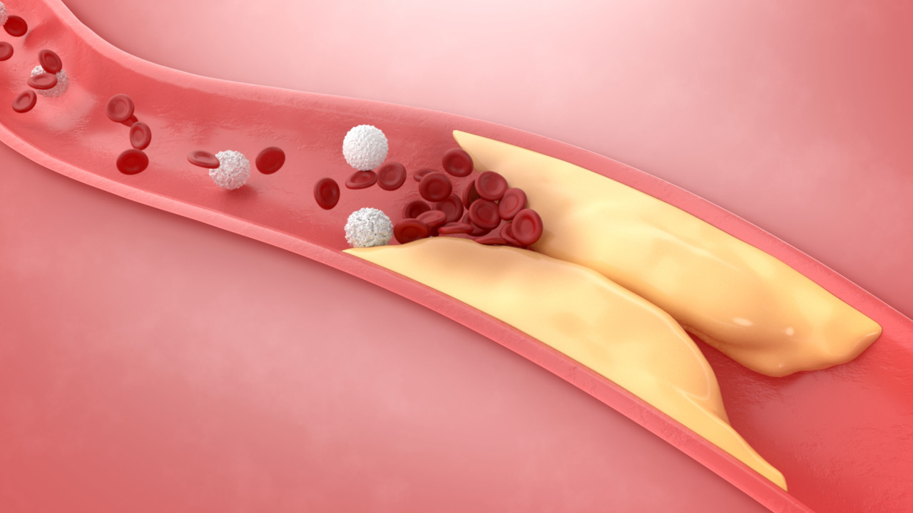 Os suplementos pouco conhecidos que ajudam a controlar o colesterol