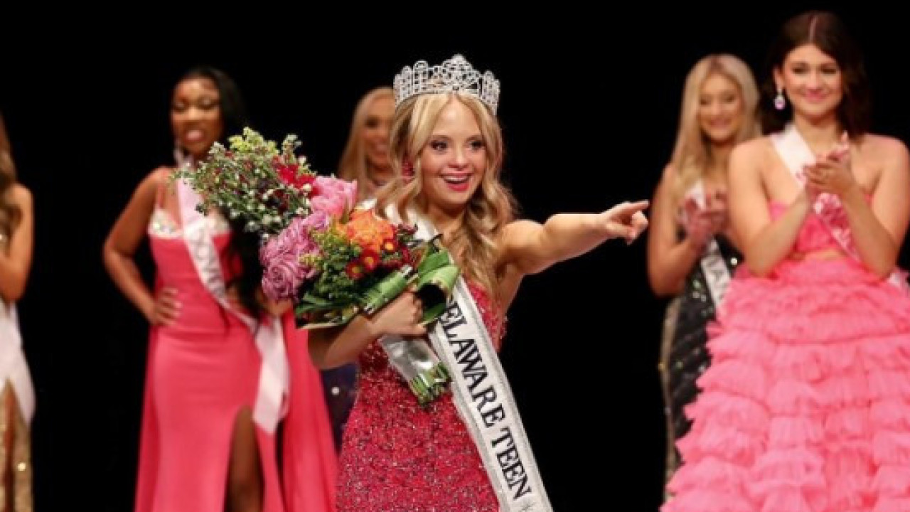 Kayla fez história ao ser 1.ª jovem com Síndrome de Down no Miss Teen EUA