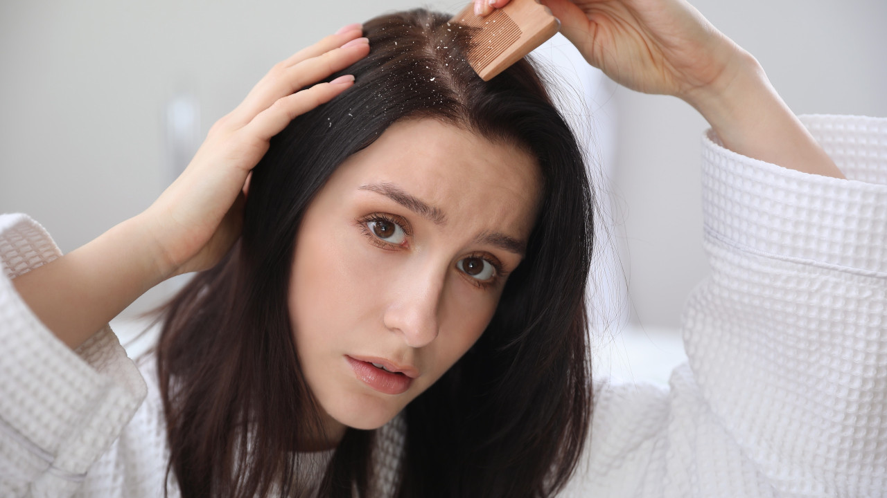 Se estiver com caspa, com que frequência deve lavar o cabelo?