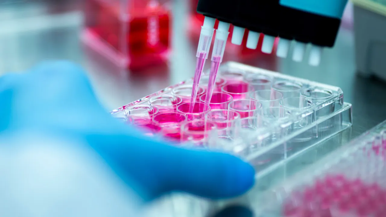 Técnica laboratorial terá morrido de peste na Sibéria. Centenas isolados