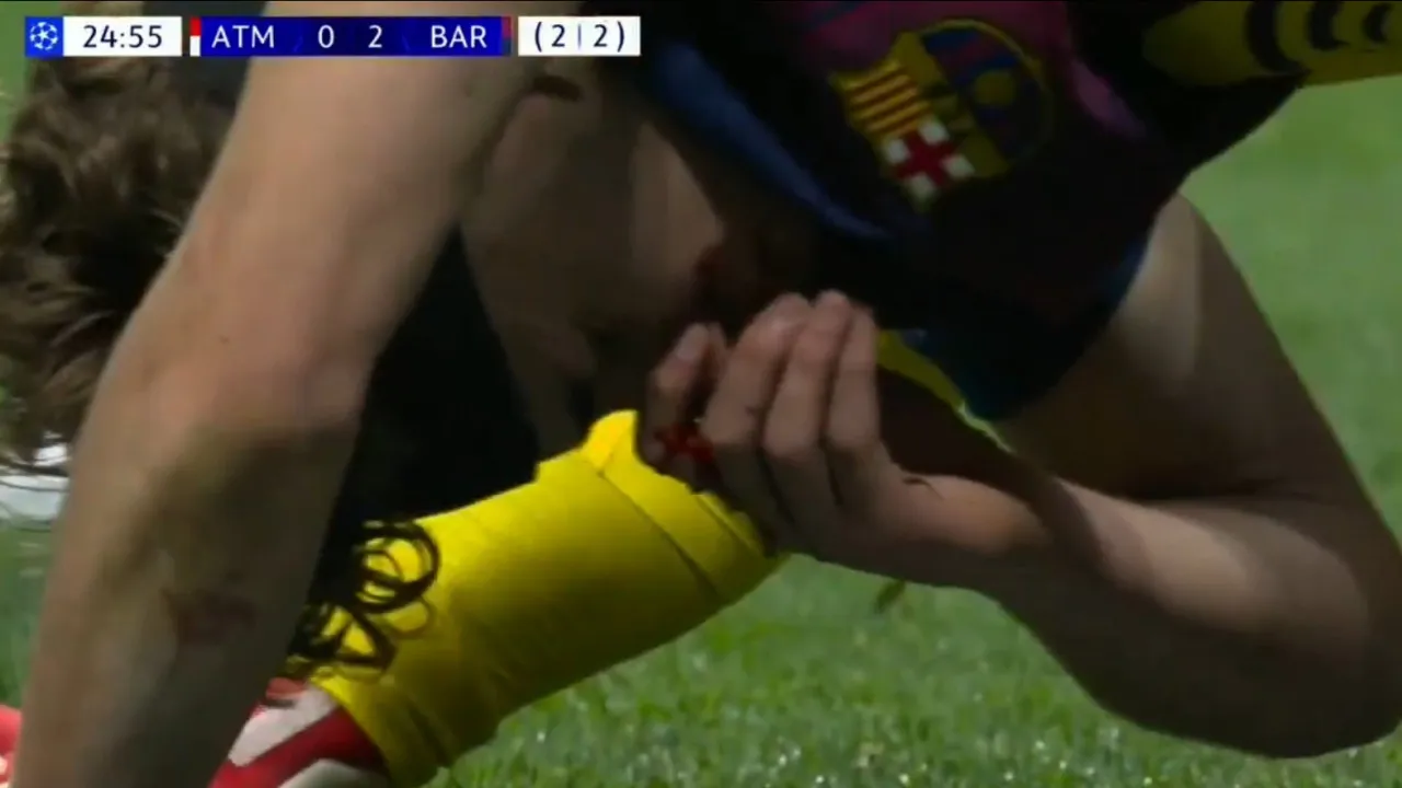 Arrepiante. Fermín dá 'corpo às balas' pelo Barcelona e acaba... em sangue