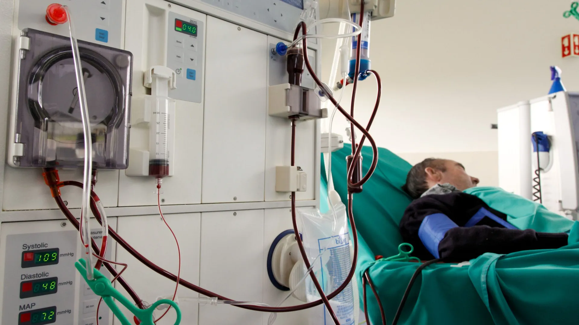 
                    Doses personalizadas de hemodiálise aumentam sobrevivência dos doentes
                