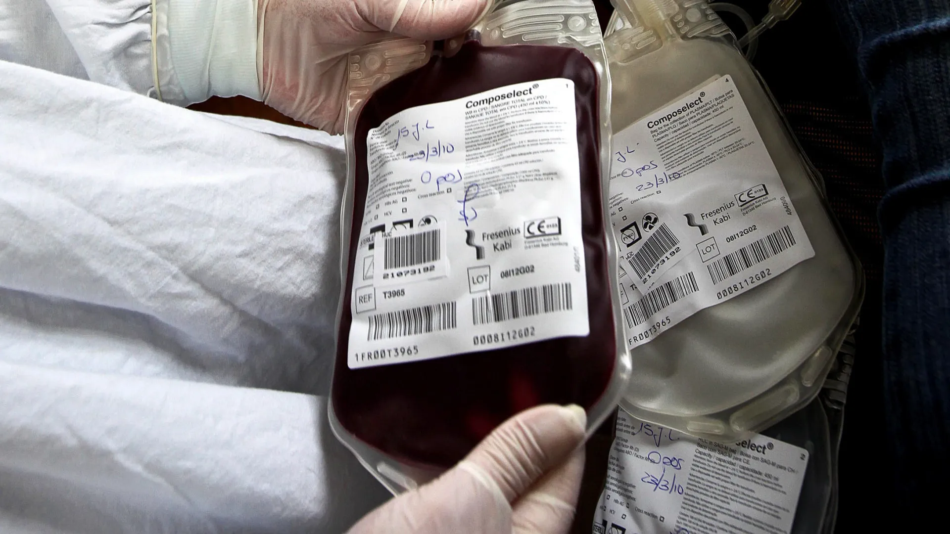 
                    IPO Porto alerta para diminuição de dadores e apela à doação de sangue
                