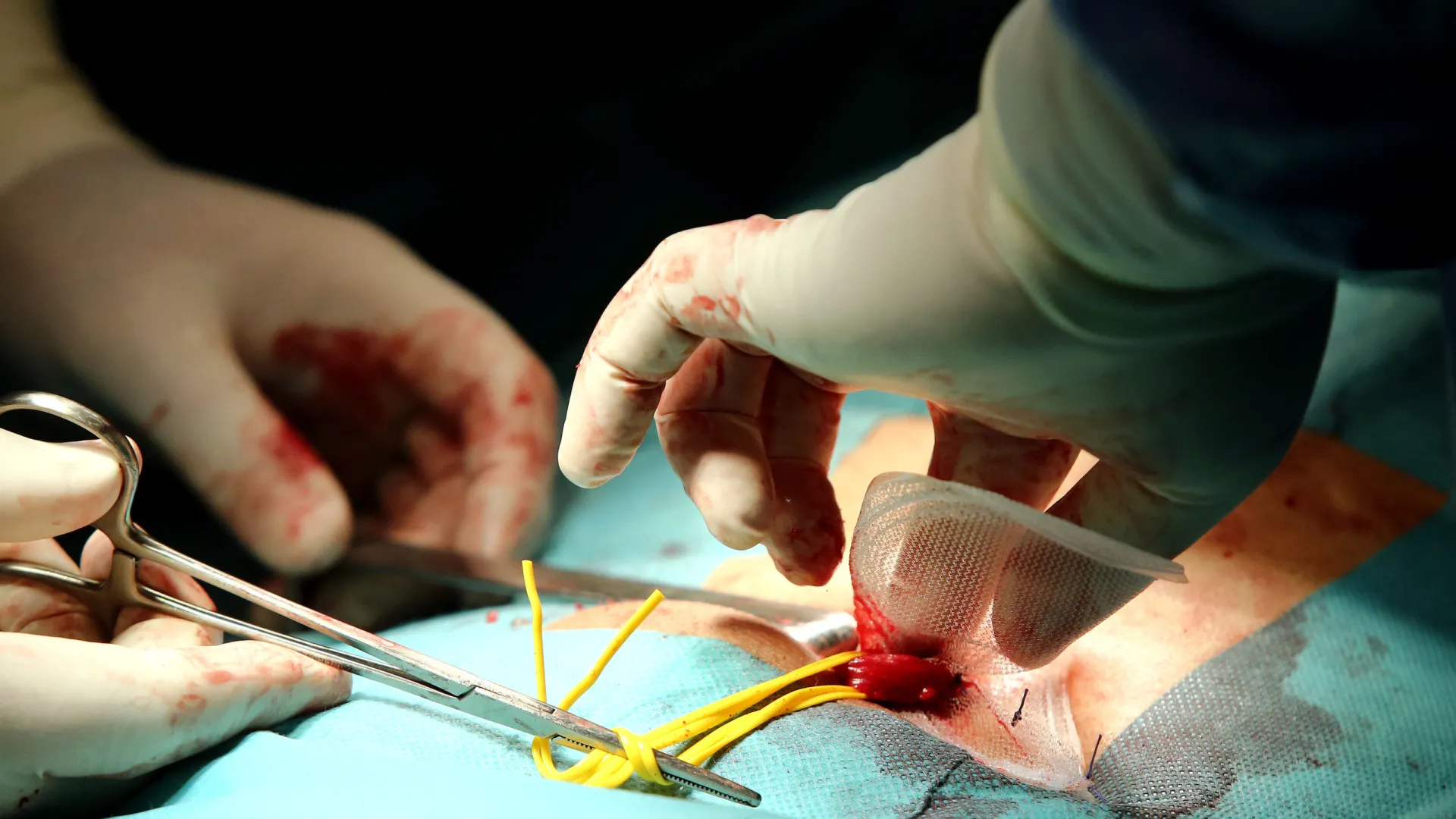 Saúde? Plano de emergência com oito medidas prioritárias por cumprir