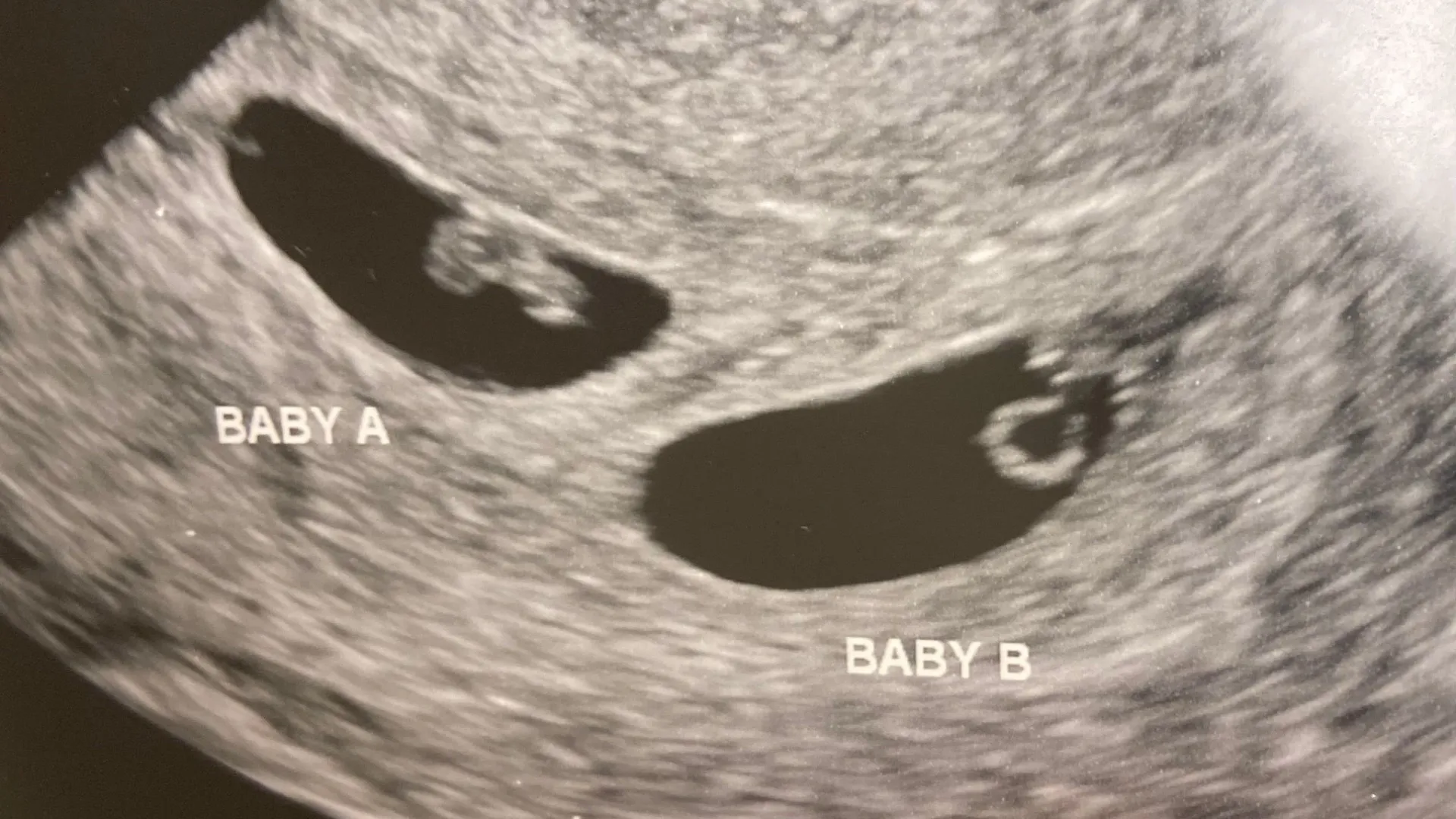 
                    Bilionário chinês usa gestação de substituição nos EUA para ter mais de 100 filhos
                