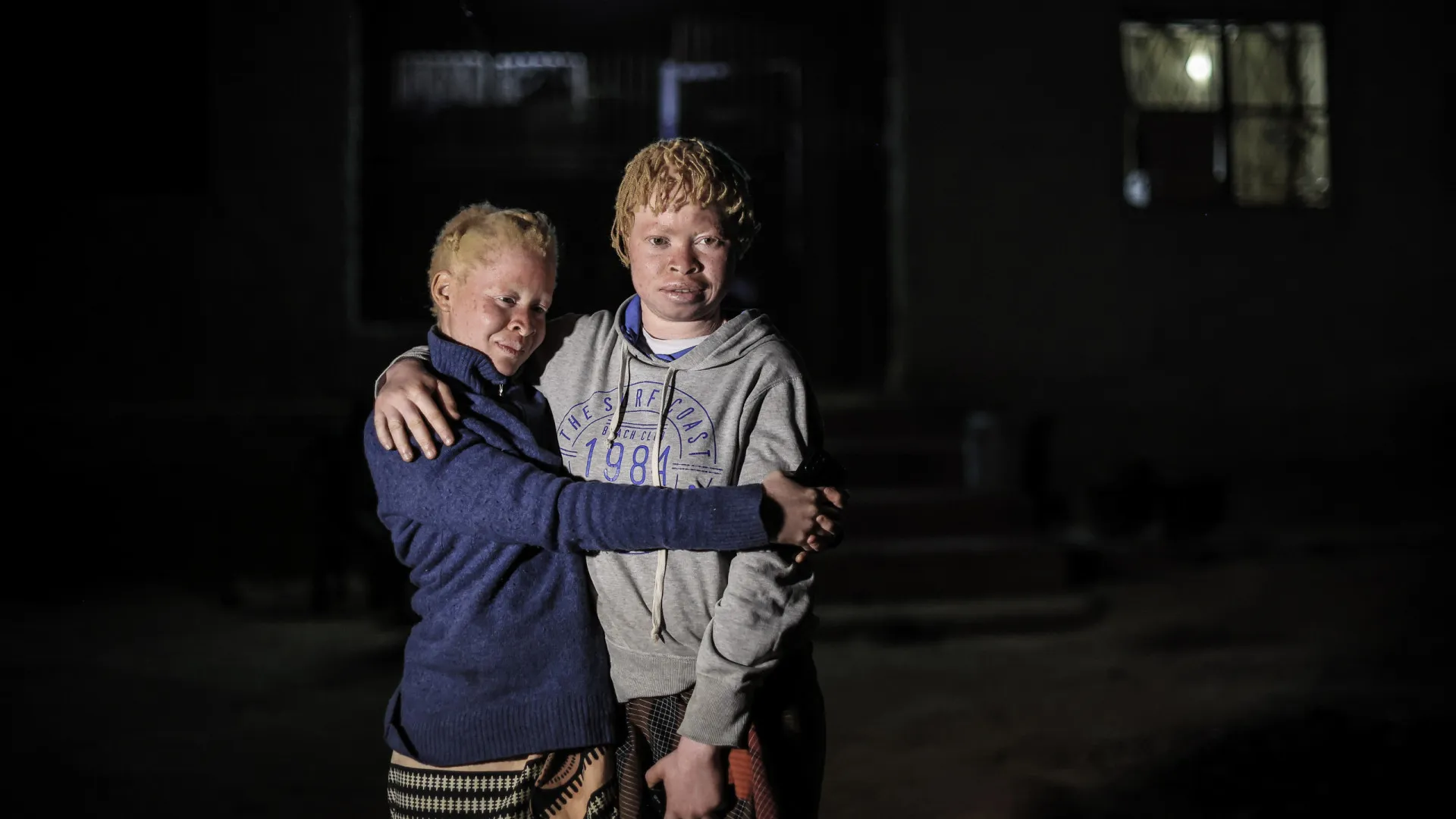 
                    ONU: Educação pode travar perseguição a pessoas com albinismo em África
                