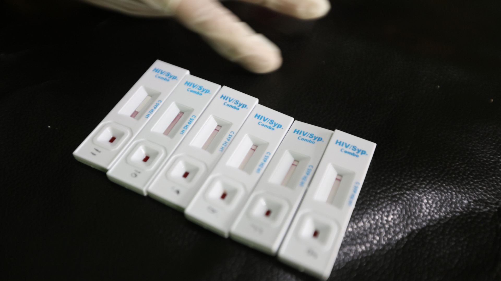 Angola regista 13 mil mortes e 28 mil novas infeções anuais por VIH/SIDA