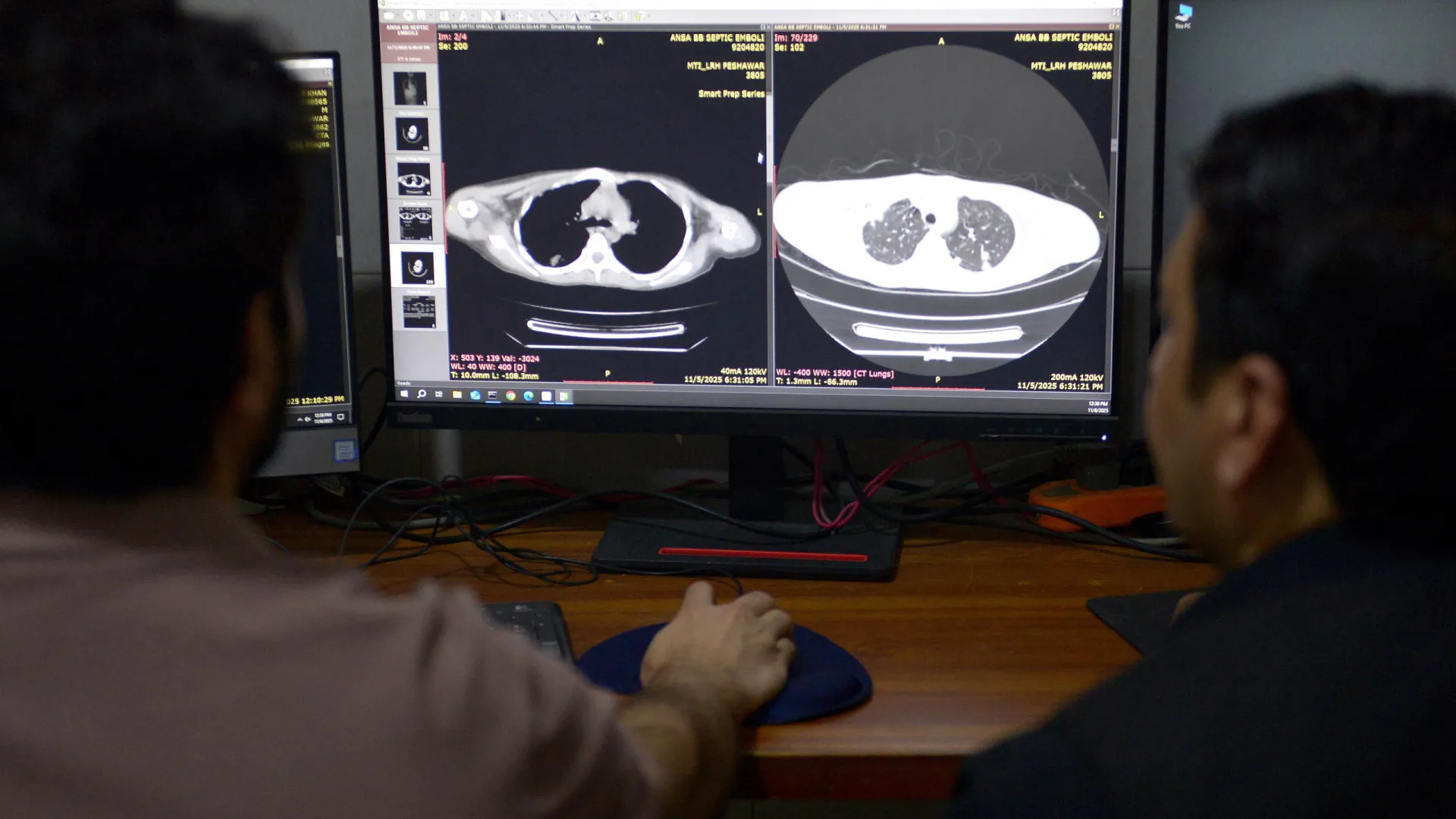 
                    SNS. Existe risco de colapso da rede convencionada de imagiologia
                