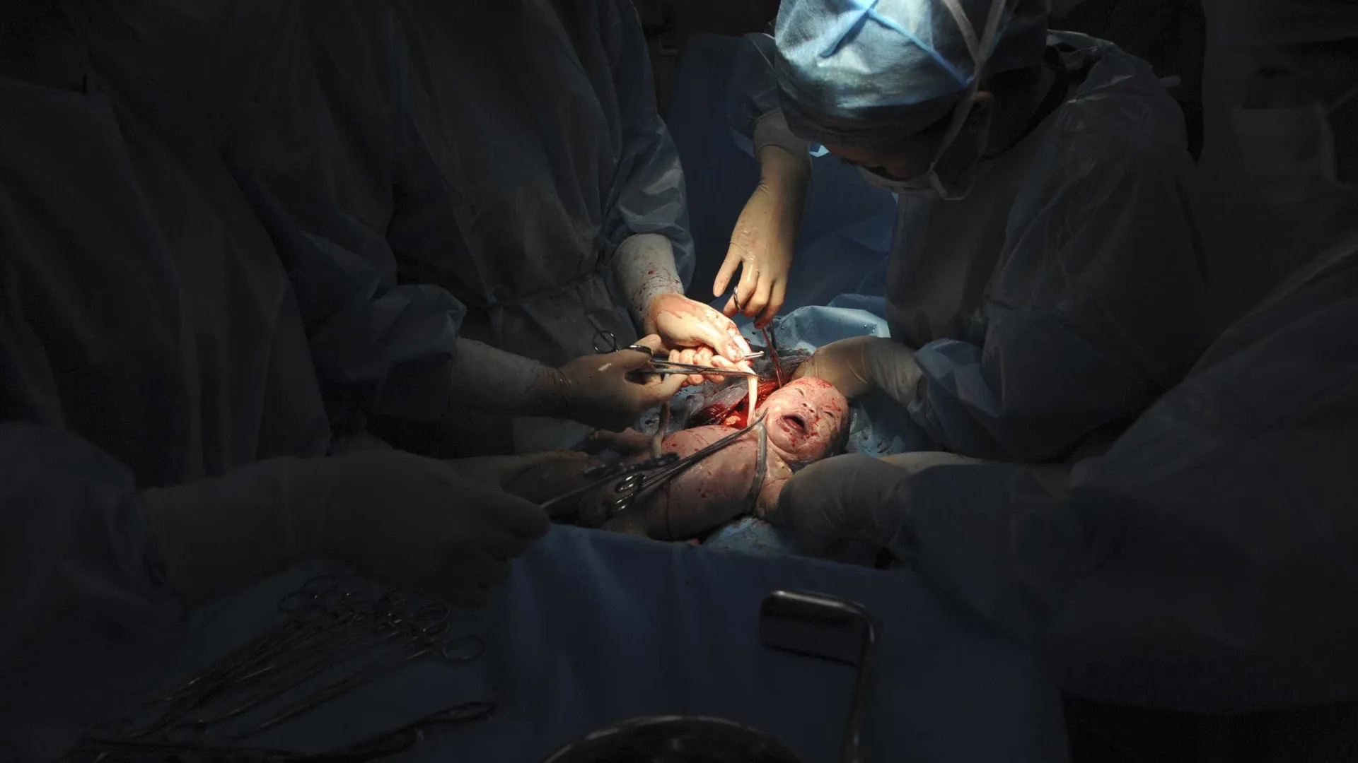 
                    Medicina Reprodutiva da Cova da Beira contribui para nascimento de 220 bebés
                