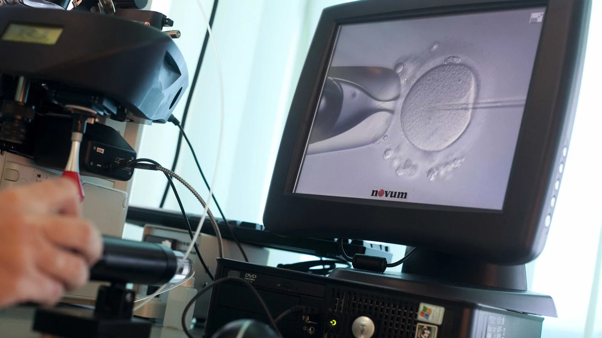 
                    Duas em cada três primeiras consultas para inseminação fora do tempo máximo
                