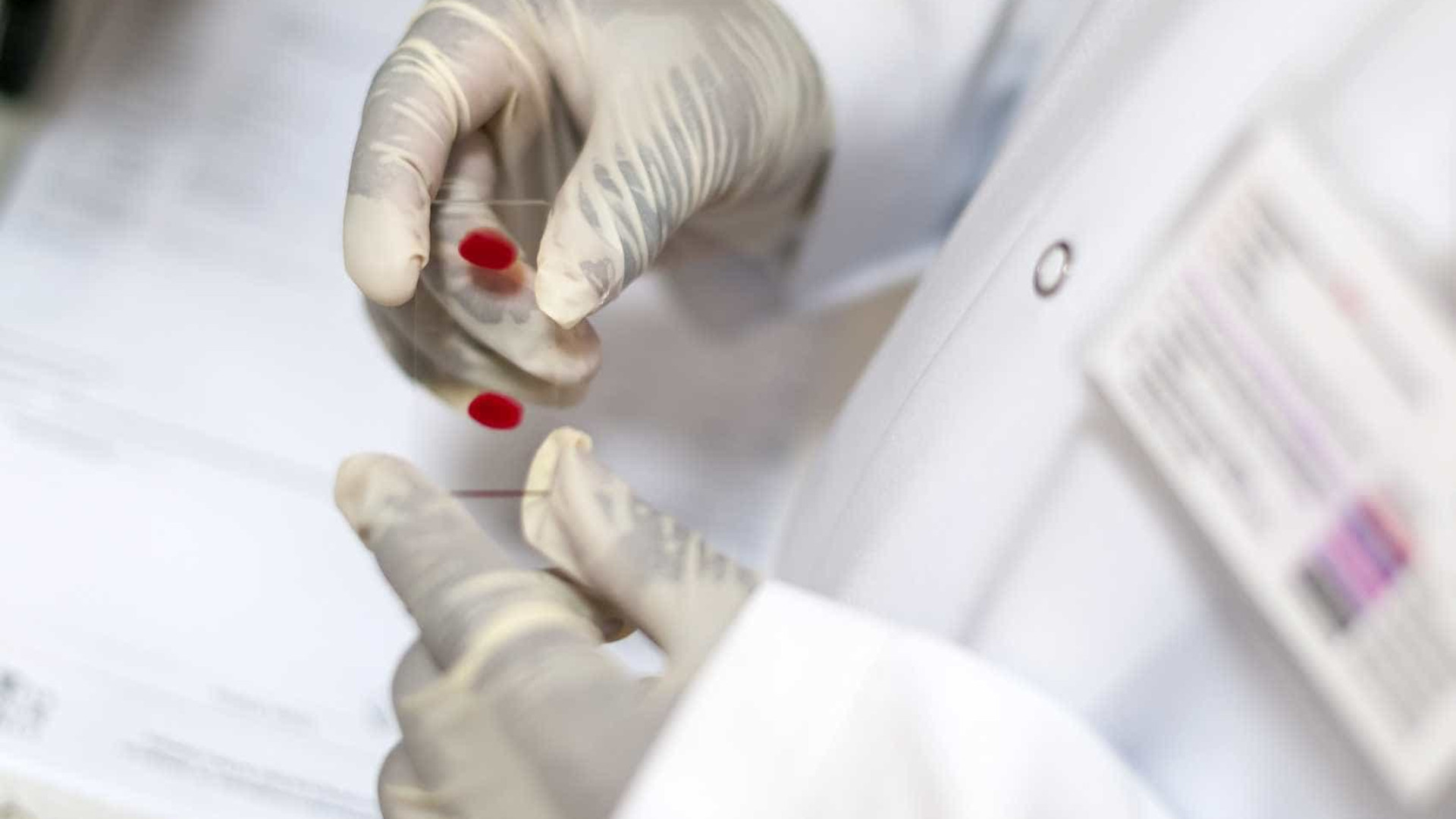 Hepatite viral crónica afeta cinco milhões de pessoas na Europa