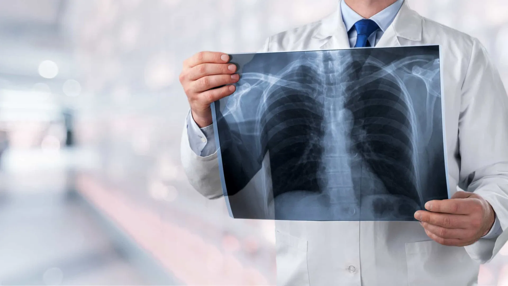
                    Pulmonale alerta: Rastreio do cancro do pulmão é urgente em Portugal
                