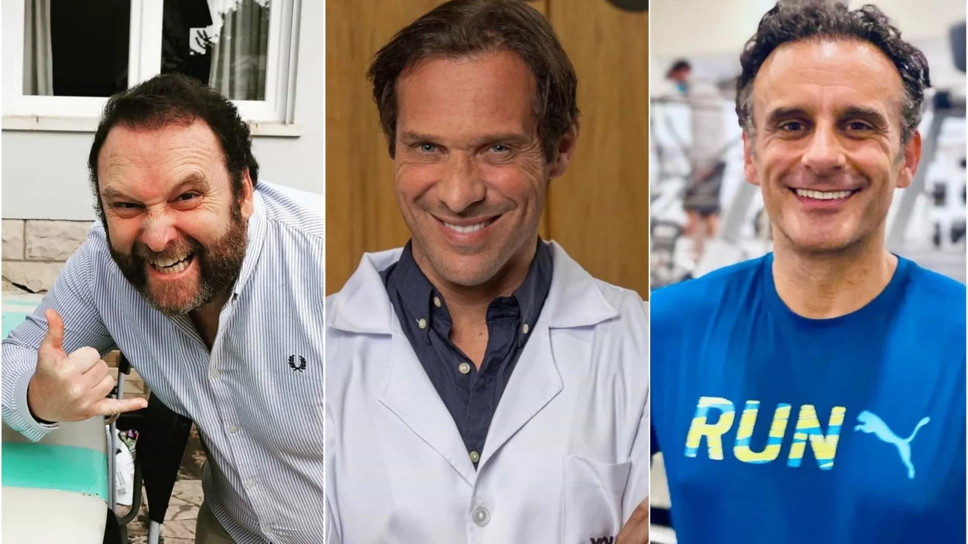 O antes e depois de 10 famosos que fizeram transplante capilar