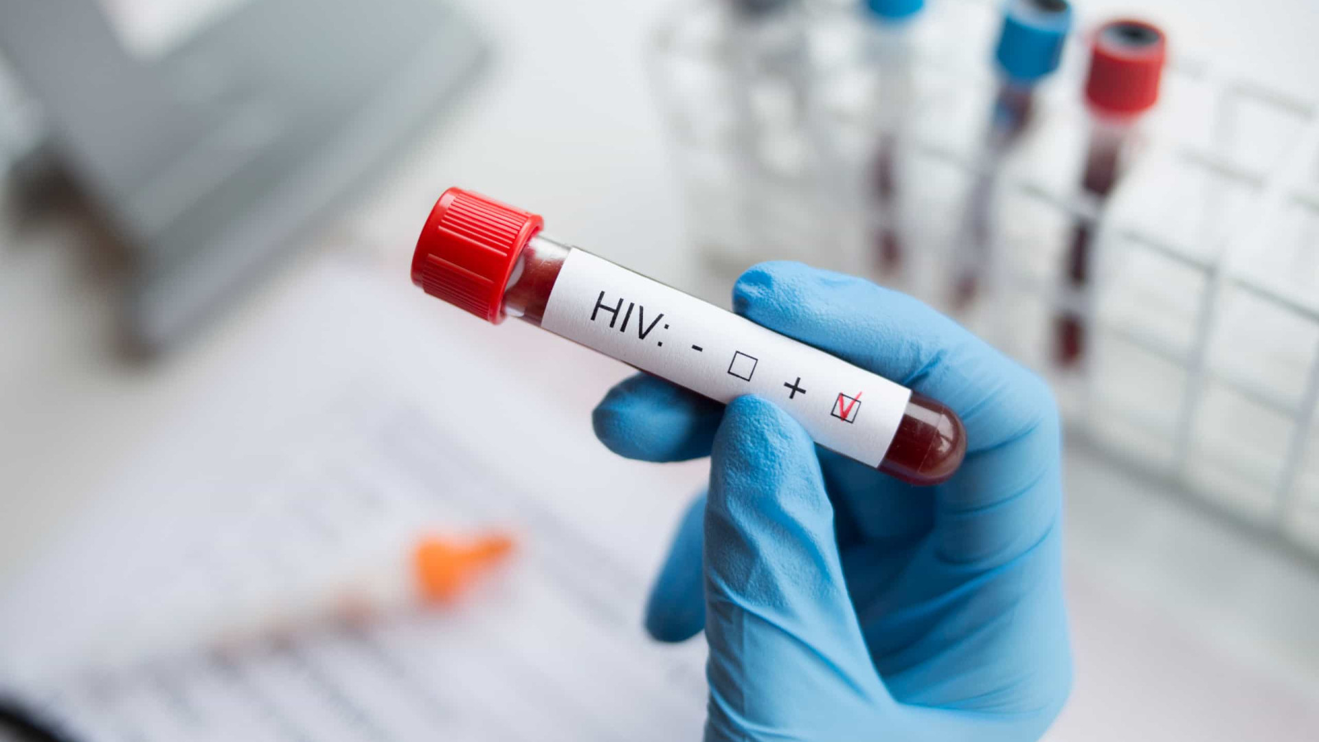 Estados Unidos aprovam tratamento preventivo para combater o VIH