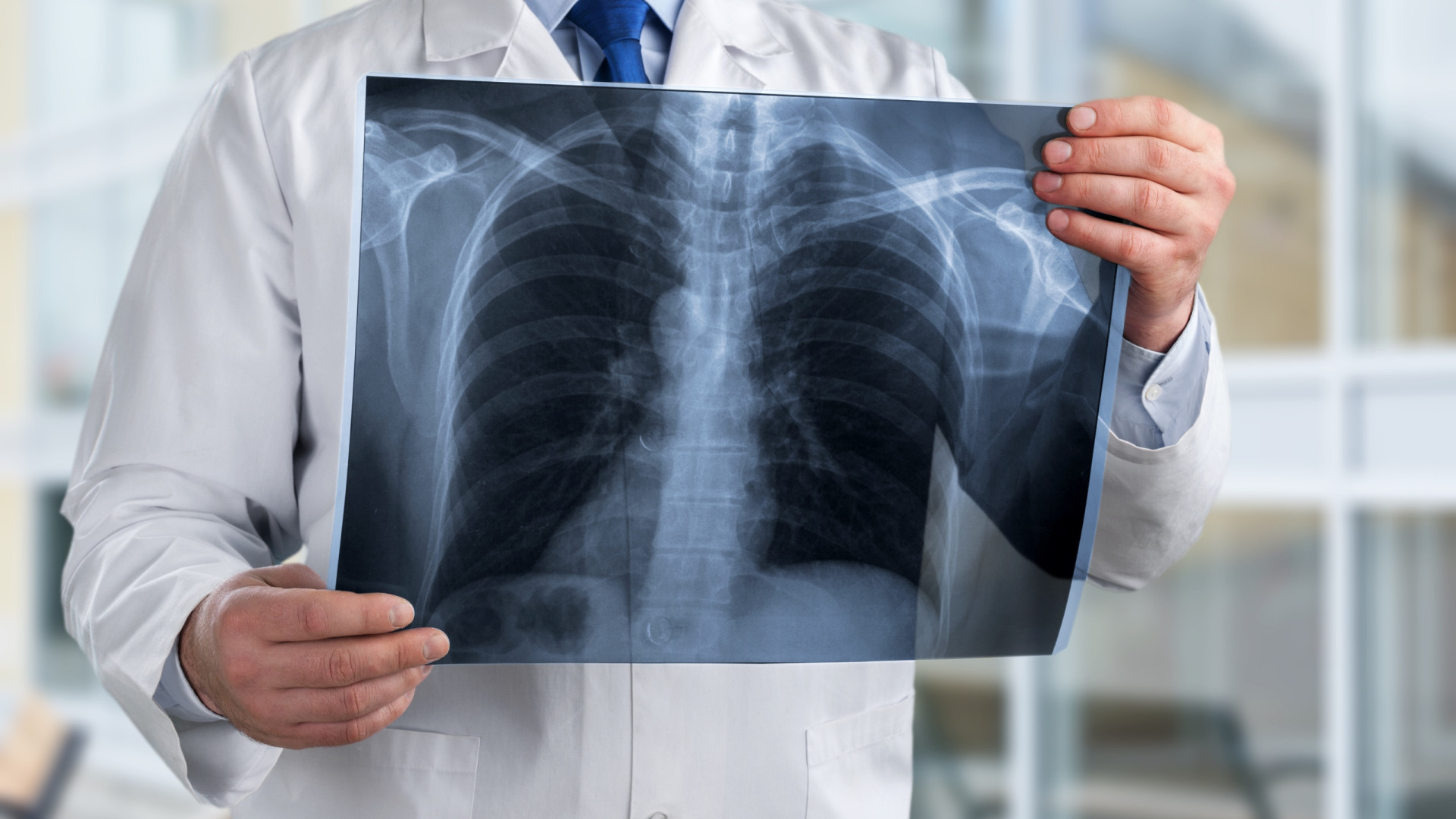 Especialistas vão definir referências para rastreio do cancro do pulmão