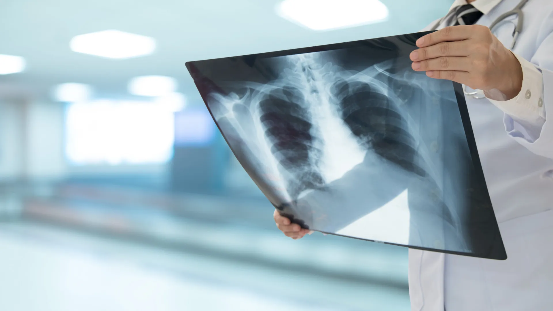 
                    Identificado mecanismo que explica risco de pneumonia grave após gripe
                