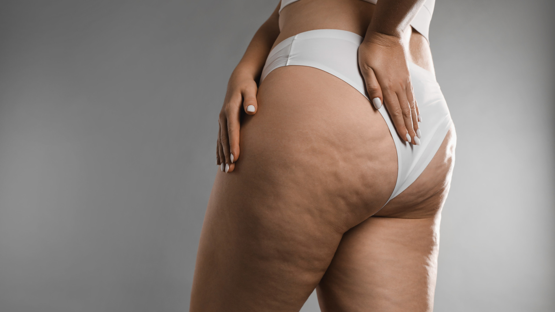 Gostava de prevenir ou diminuir a celulite? A cafeína pode ajudar