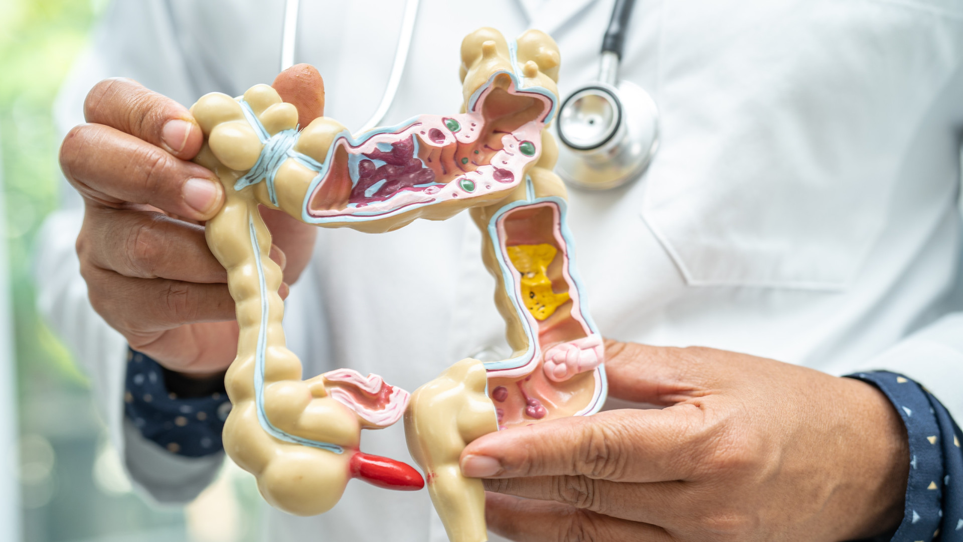 Esta é a melhor bebida para proteger a saúde intestinal, diz médico