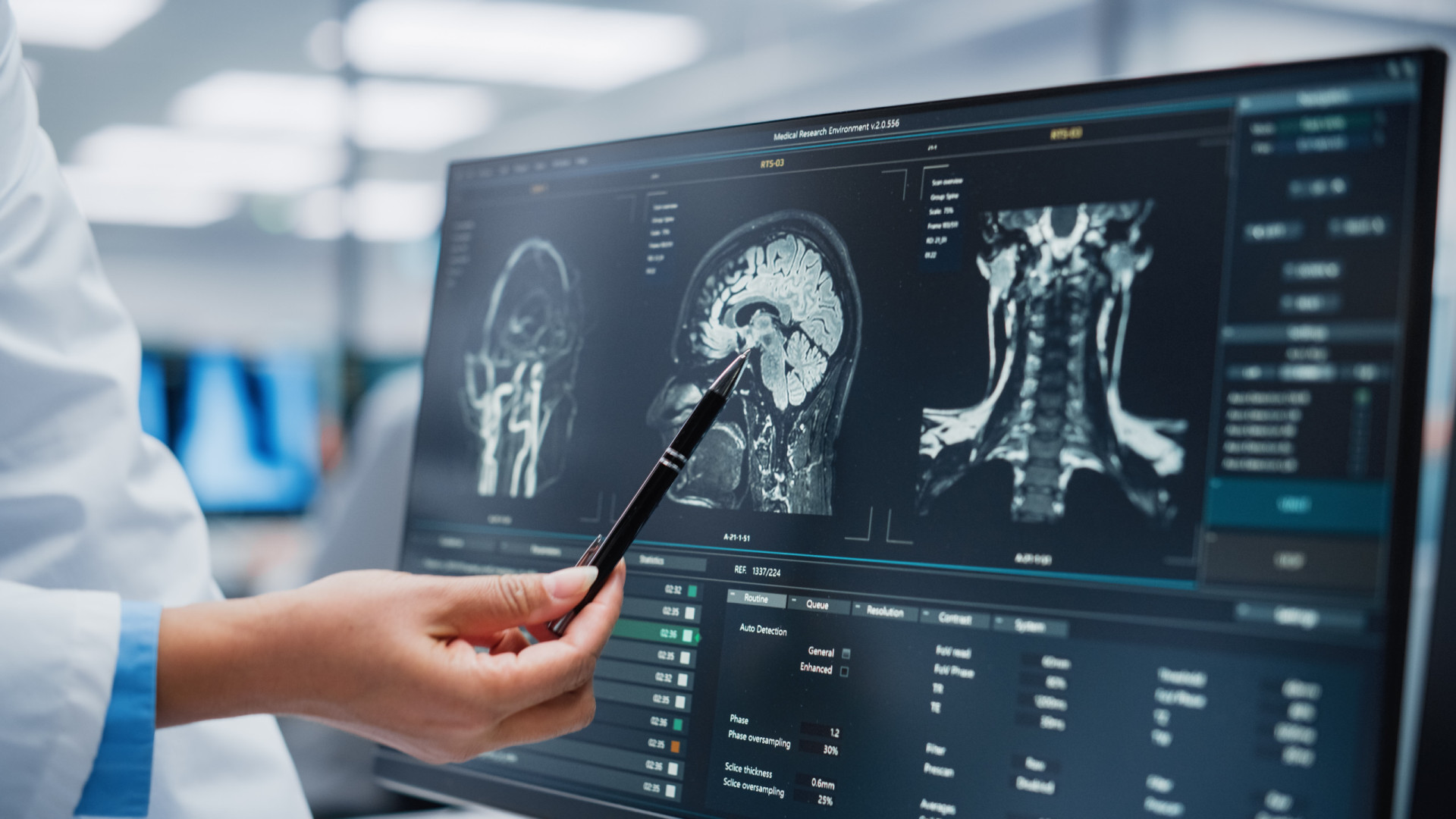 Nova tomografia cerebral que pode detetar Alzheimer precocemente