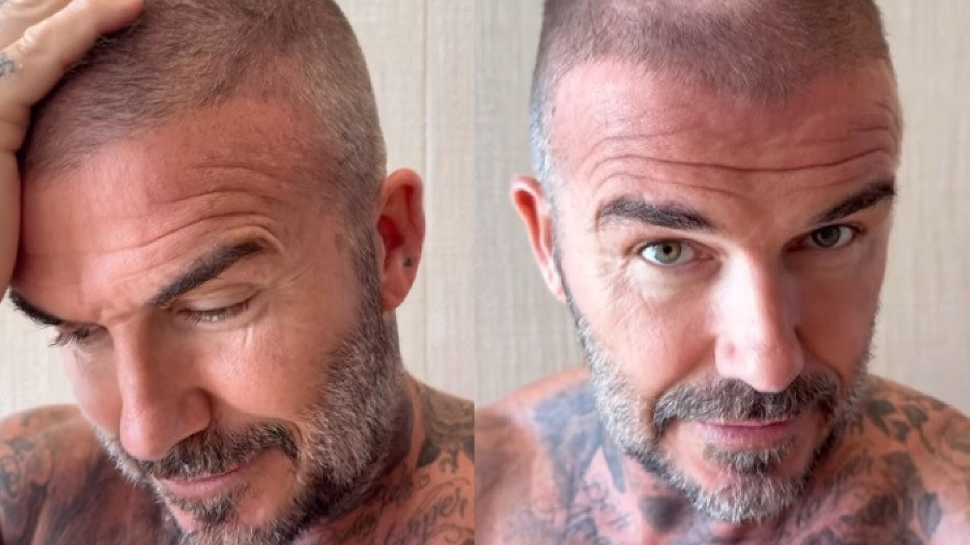 Victoria Beckham presenečena nad Davidovo novo pričesko po domači nesreči