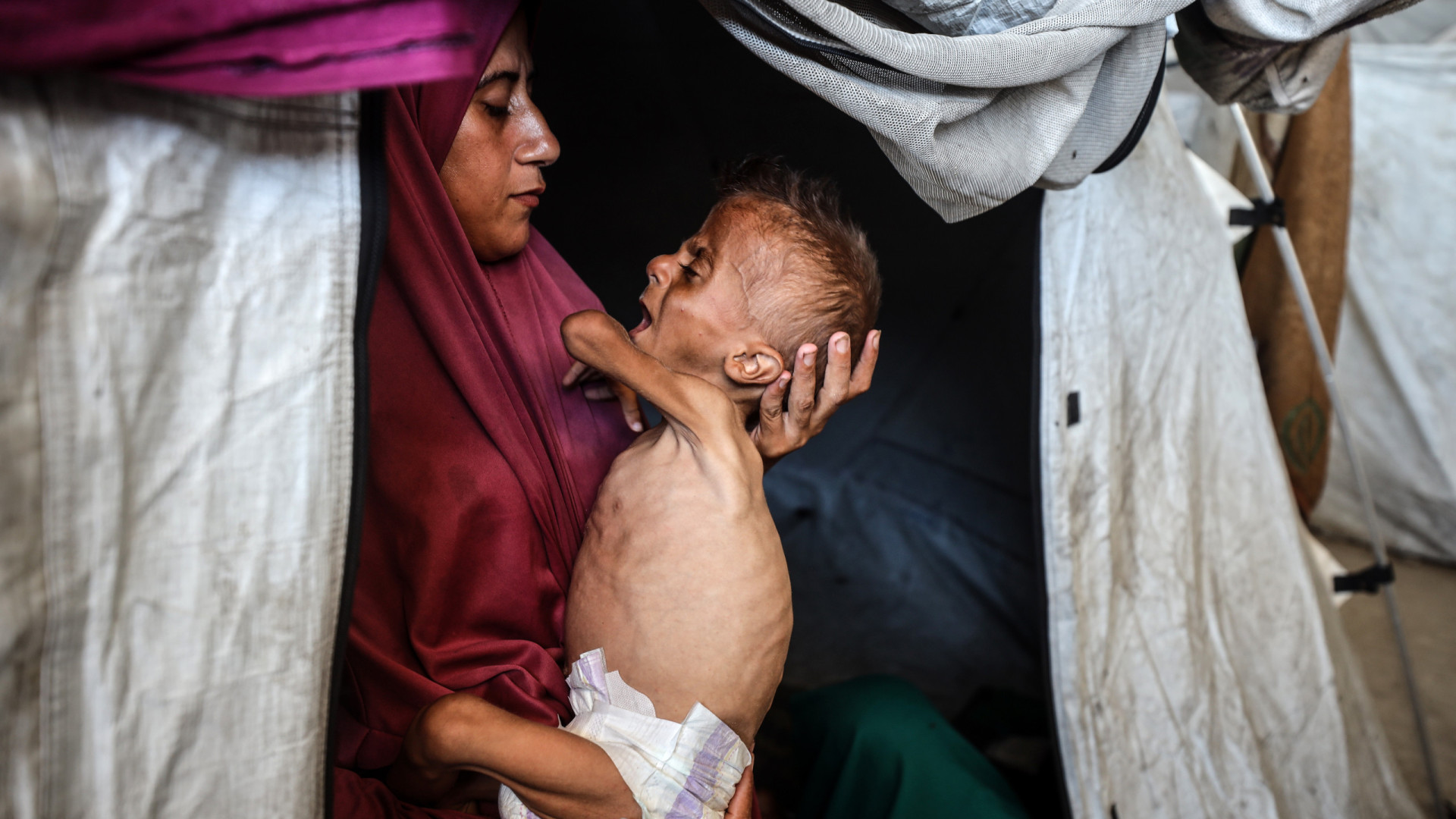 OMS alerta para níveis alarmantes da subnutrição na Faixa de Gaza