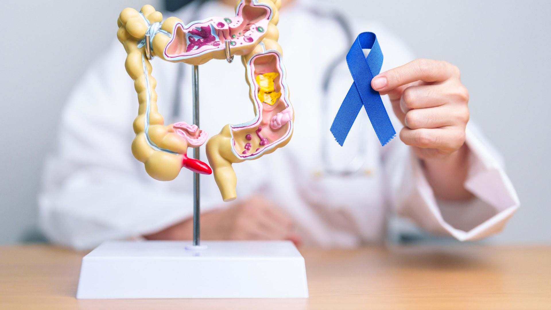 Cancro do cólon. IA reduz eficiência de médicos na deteção, diz estudo