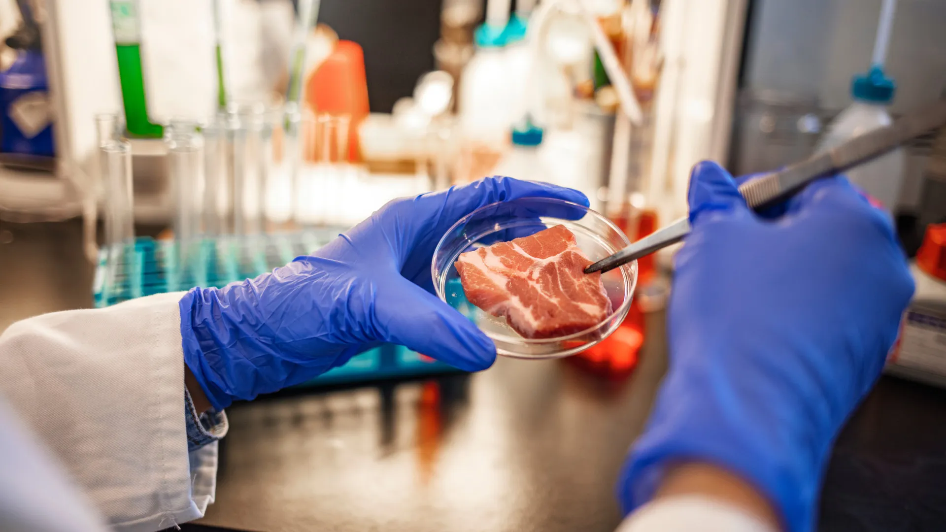 Infeções urinárias podem ser causadas pela bactéria E.coli na carne