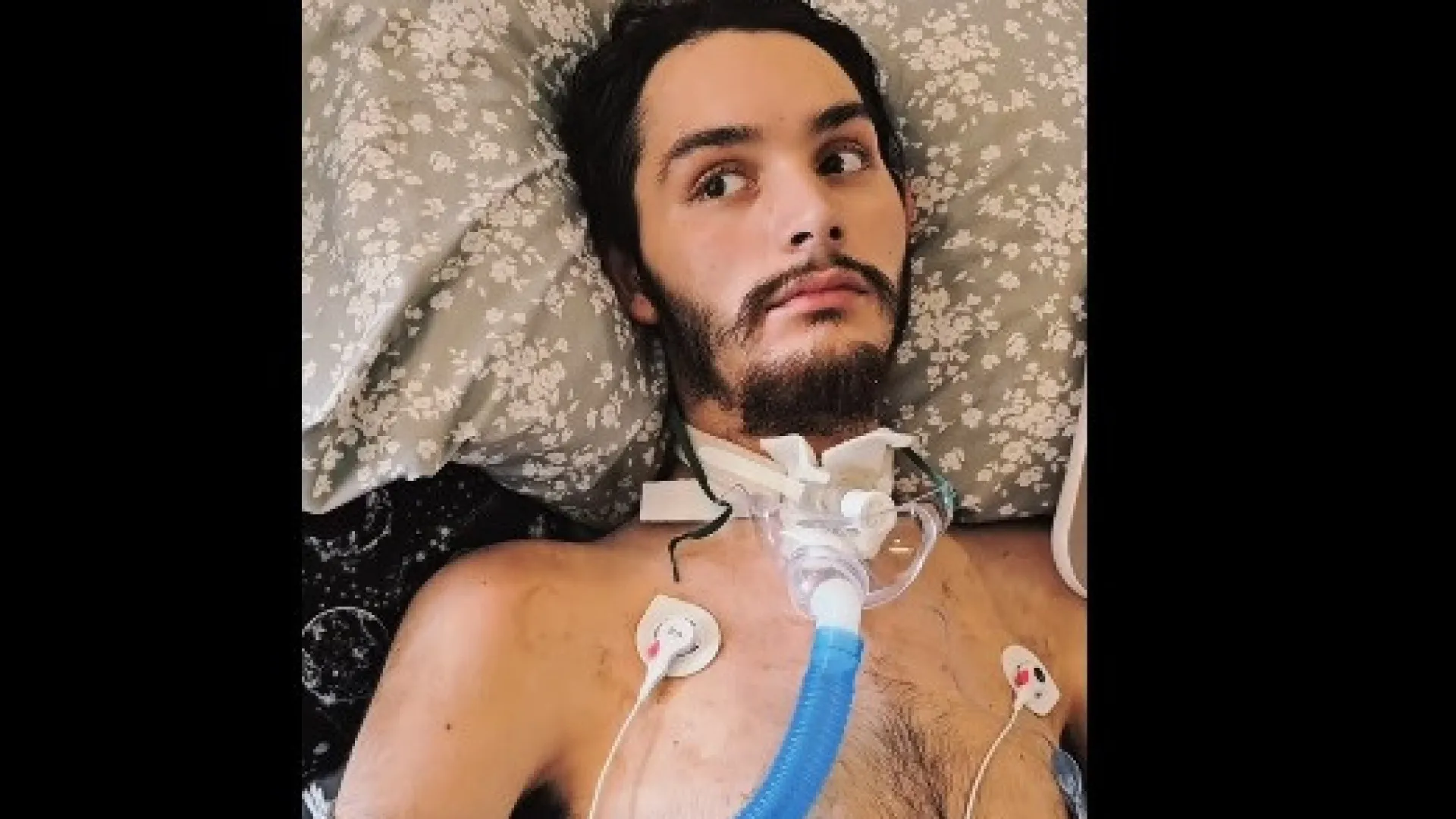 Homem em coma após acidente acorda a tempo de denunciar a namorada