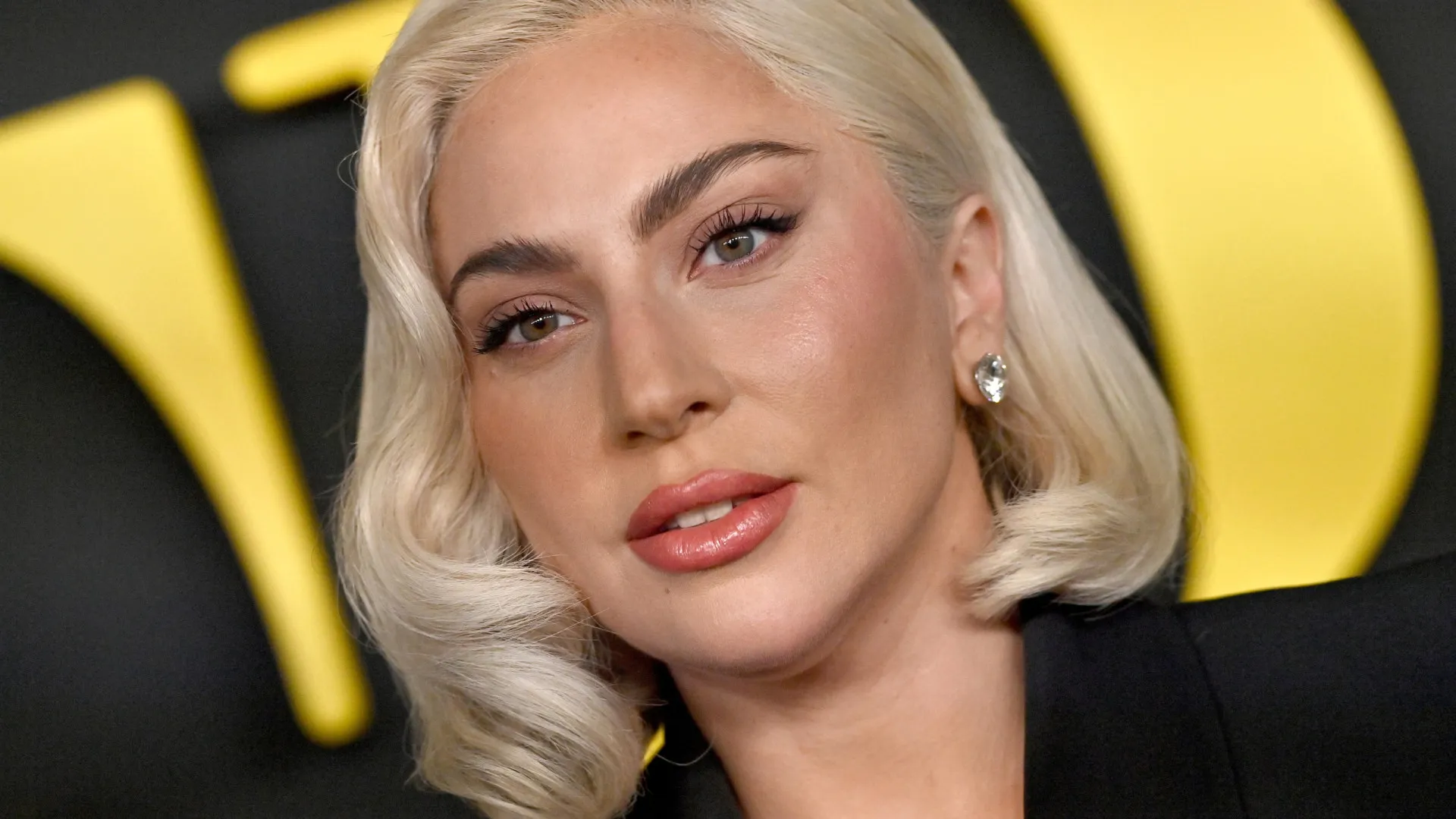 
                    Lady Gaga cancela concerto por motivos de saúde. 