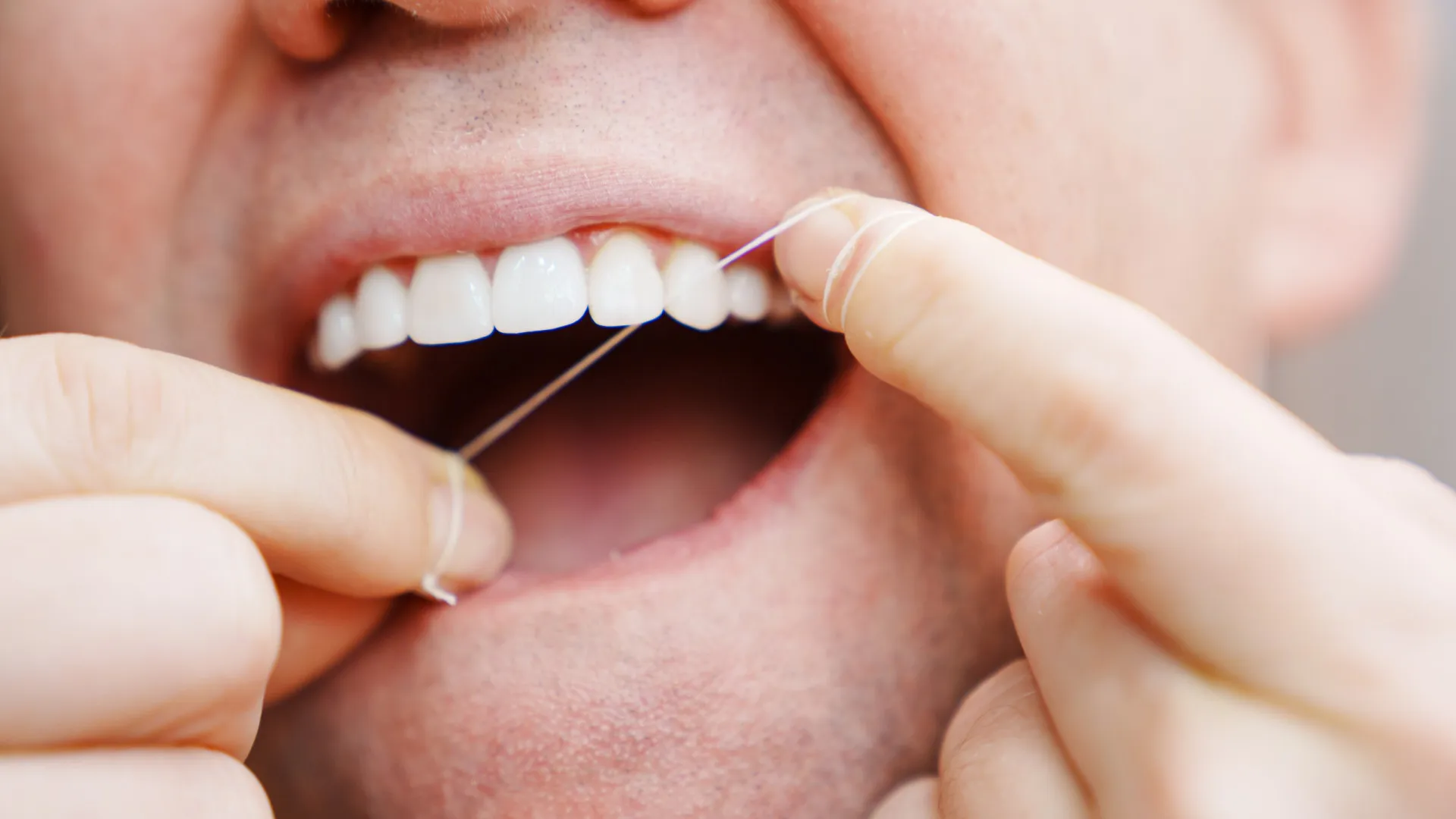 
                    O sinal de alerta no fio dentário que diz muito sobre a sua saúde
                