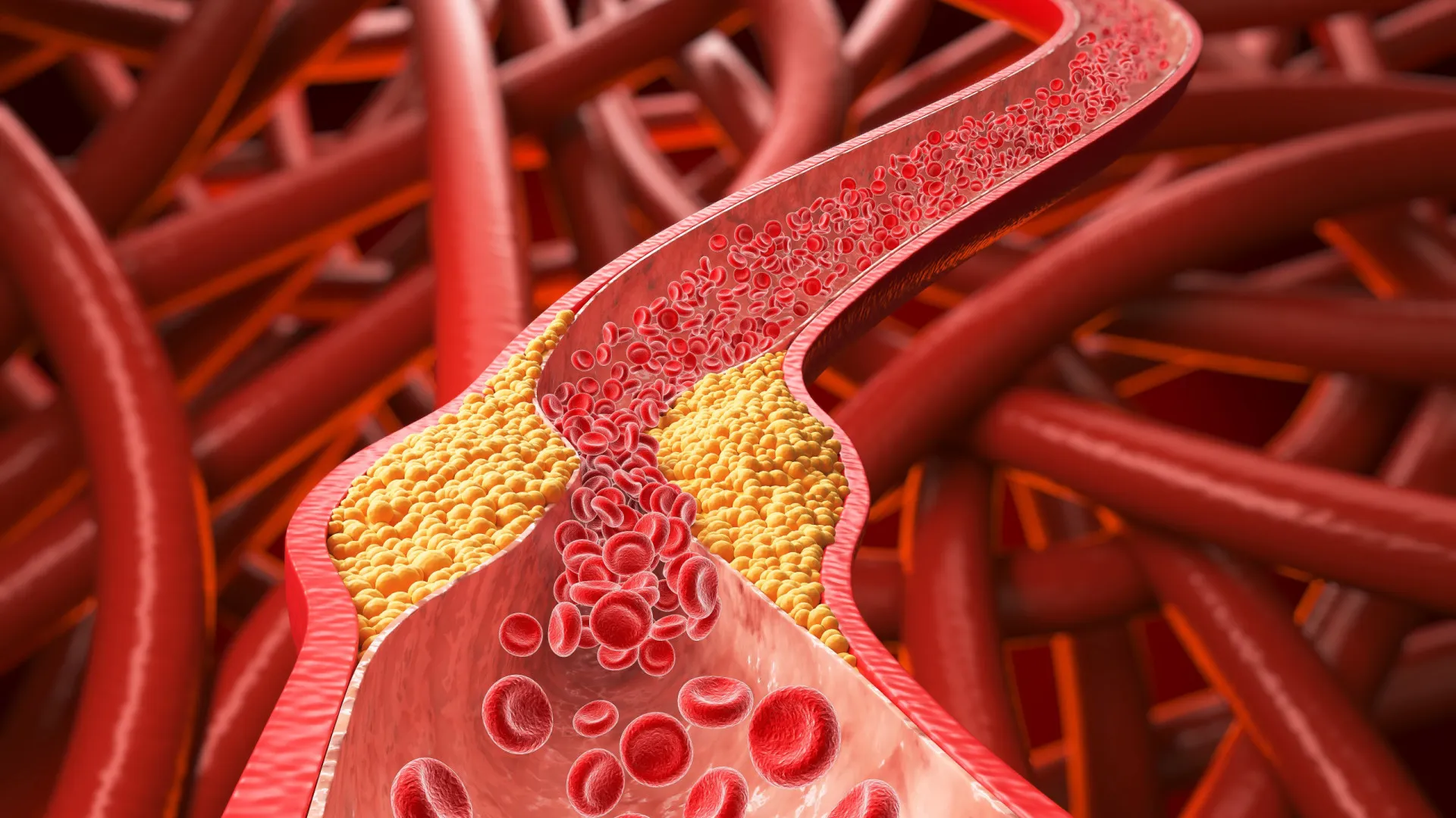 
                    Cardiologista revela a dieta que ajuda a baixar os níveis de colesterol
                