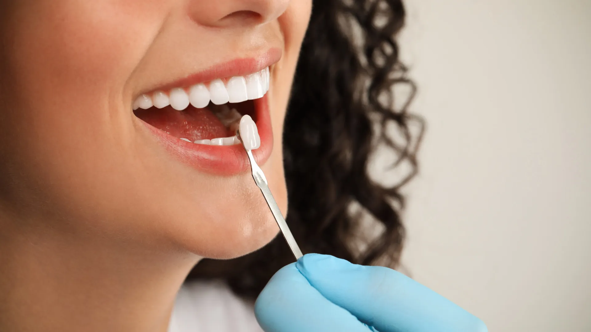 
                    Cabelo poderá curar cáries e regenerar esmalte dentário, diz estudo
                