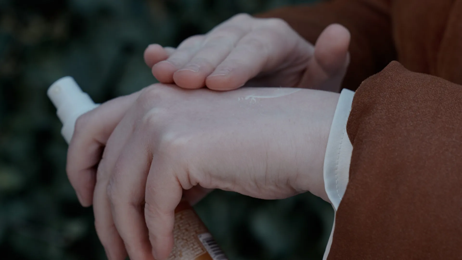 
                    Albinismo não é compreendido em Portugal e faltam dados, diz ONU
                