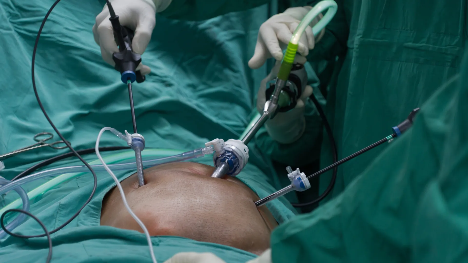 
                    Hérnia encarcerada: Entenda a condição que afetou Presidente da República
                