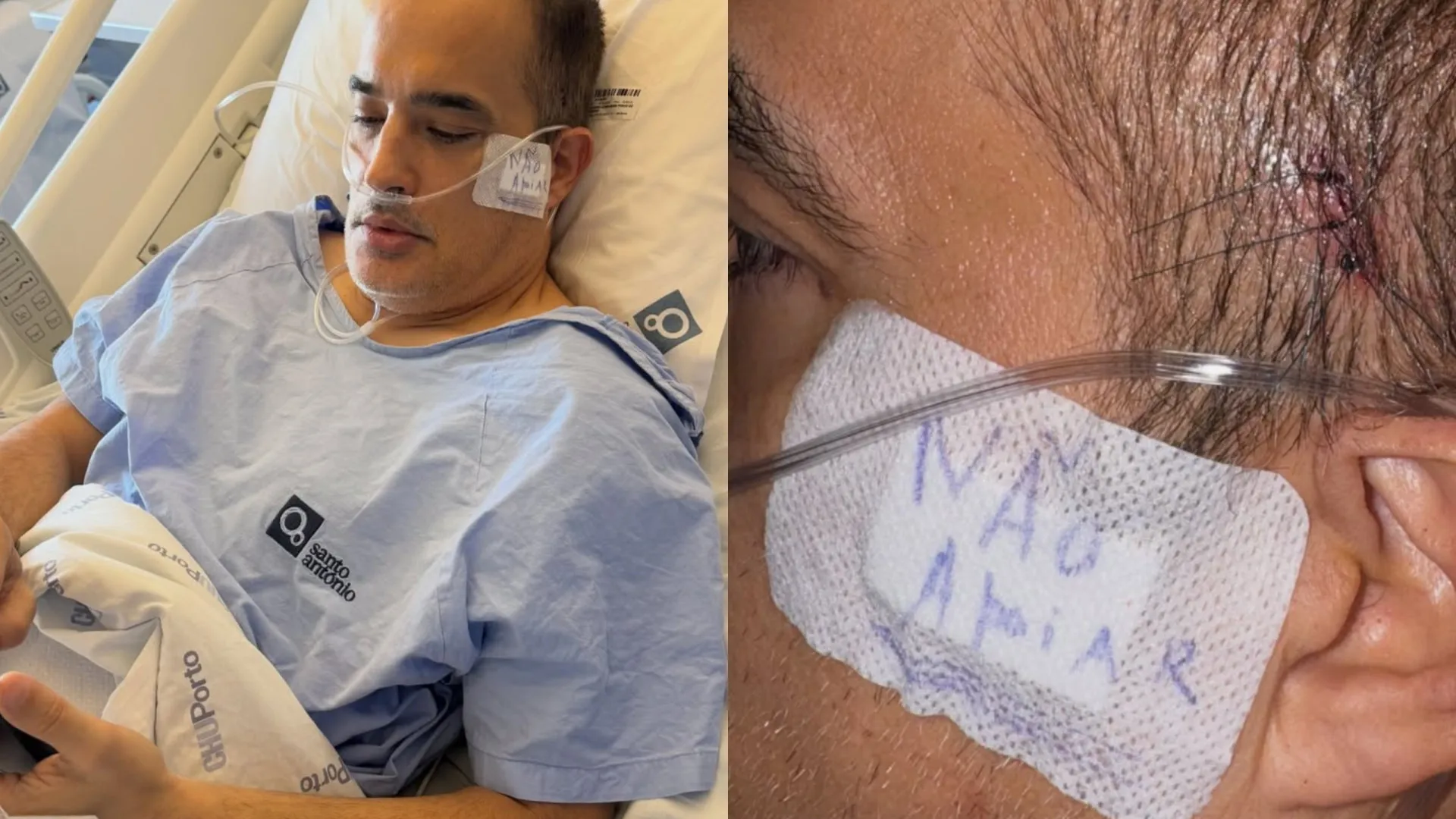 
                    Ricardo Azevedo explica acidente. 