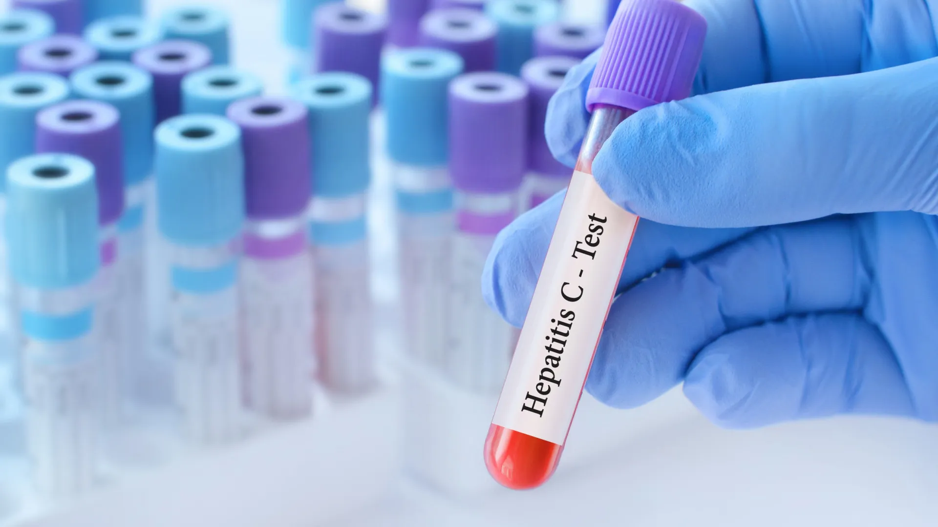 
                    Hepatite C: Novo teste rápido de 15 minutos pode melhorar tratamento
                