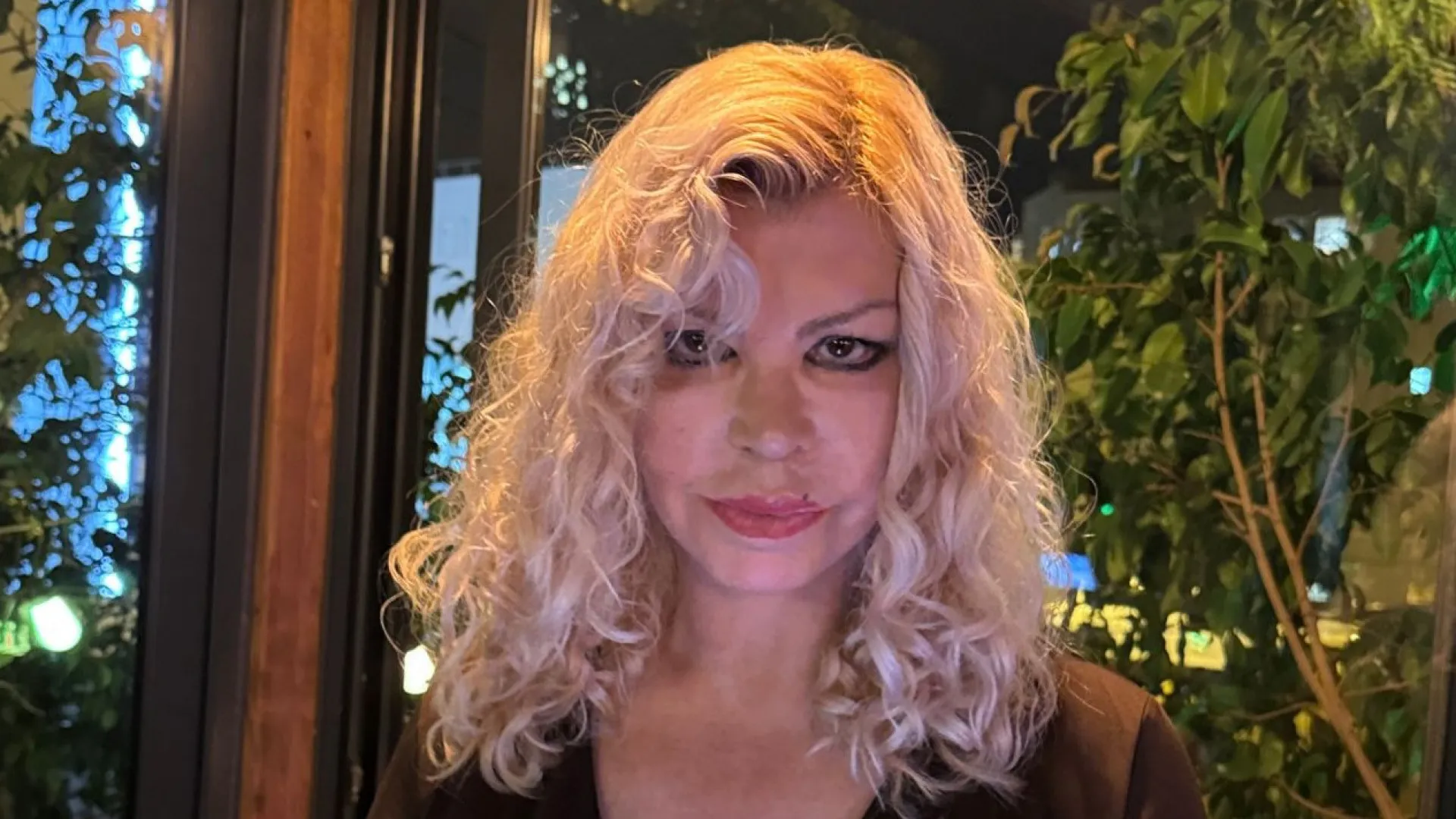 
                    As imagens impressionantes de Kina após cirurgia estética
                