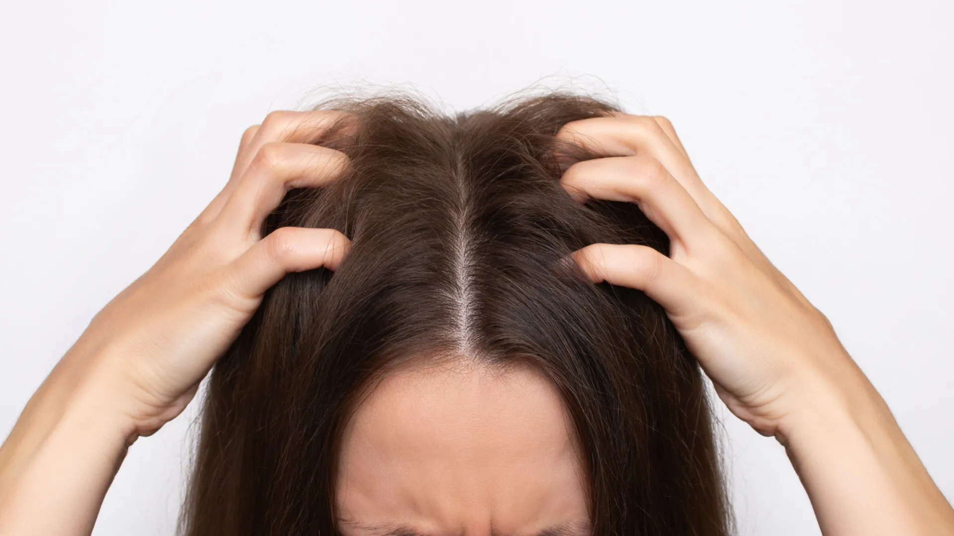 
                    Diga adeus a este problema capilar! Eis as dicas para um cabelo saudável
                