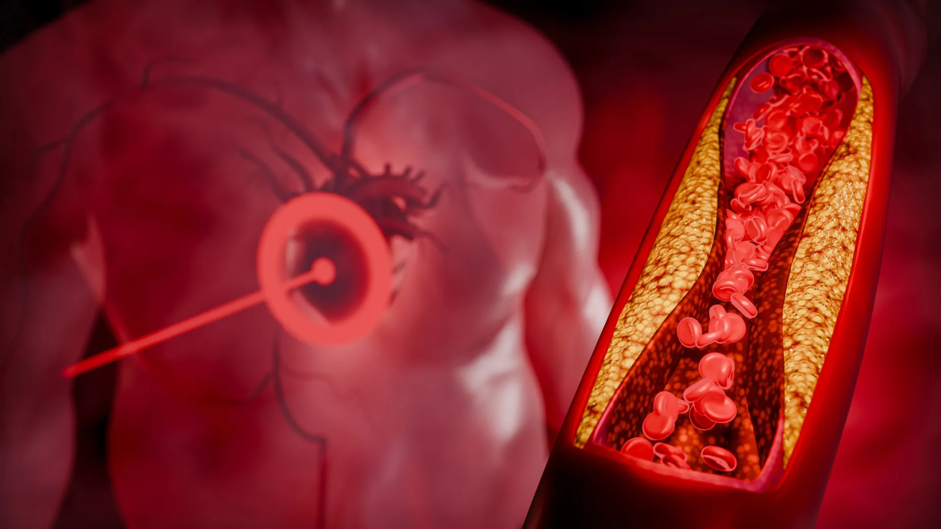 
                    O alimento barato que ajuda a reduzir o colesterol em 4 semanas
                