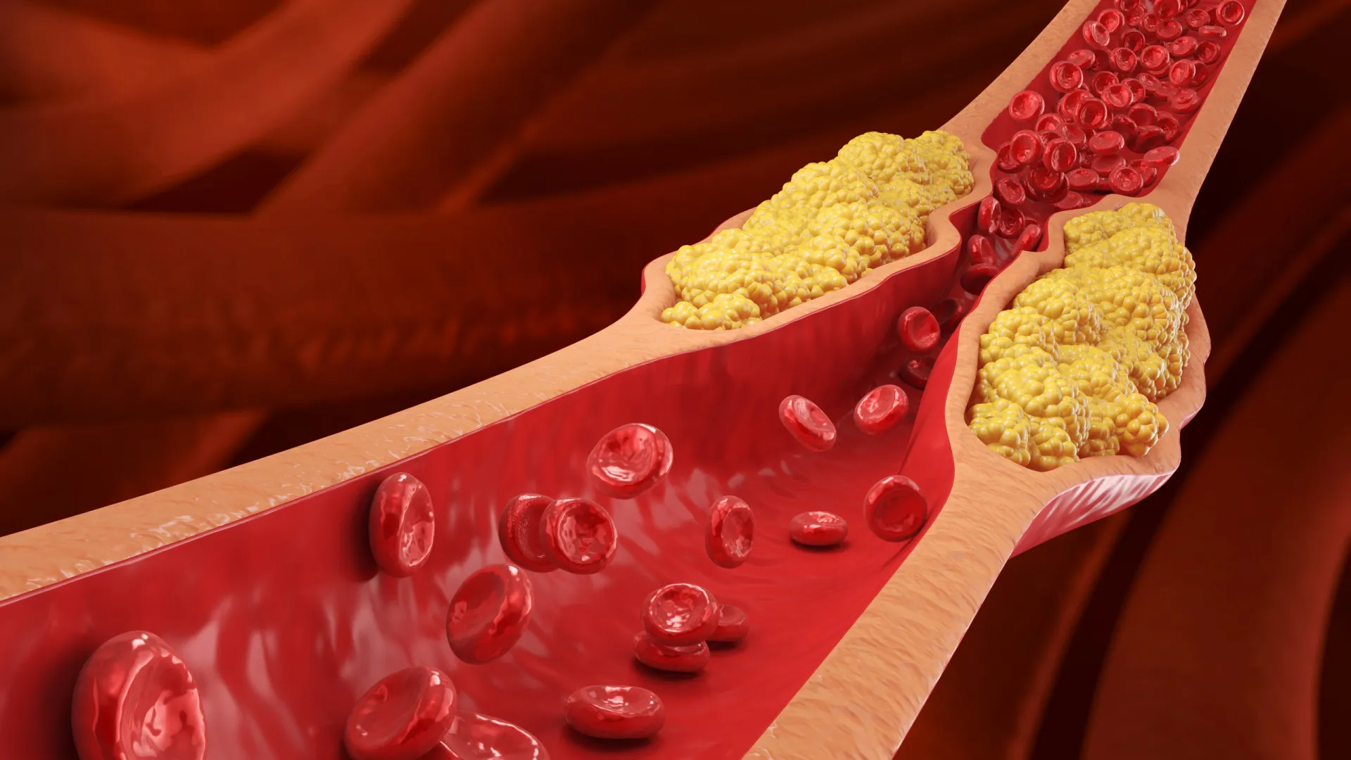 
                    Quer baixar o colesterol? Nutricionistas recomendam este pequeno almoço
                