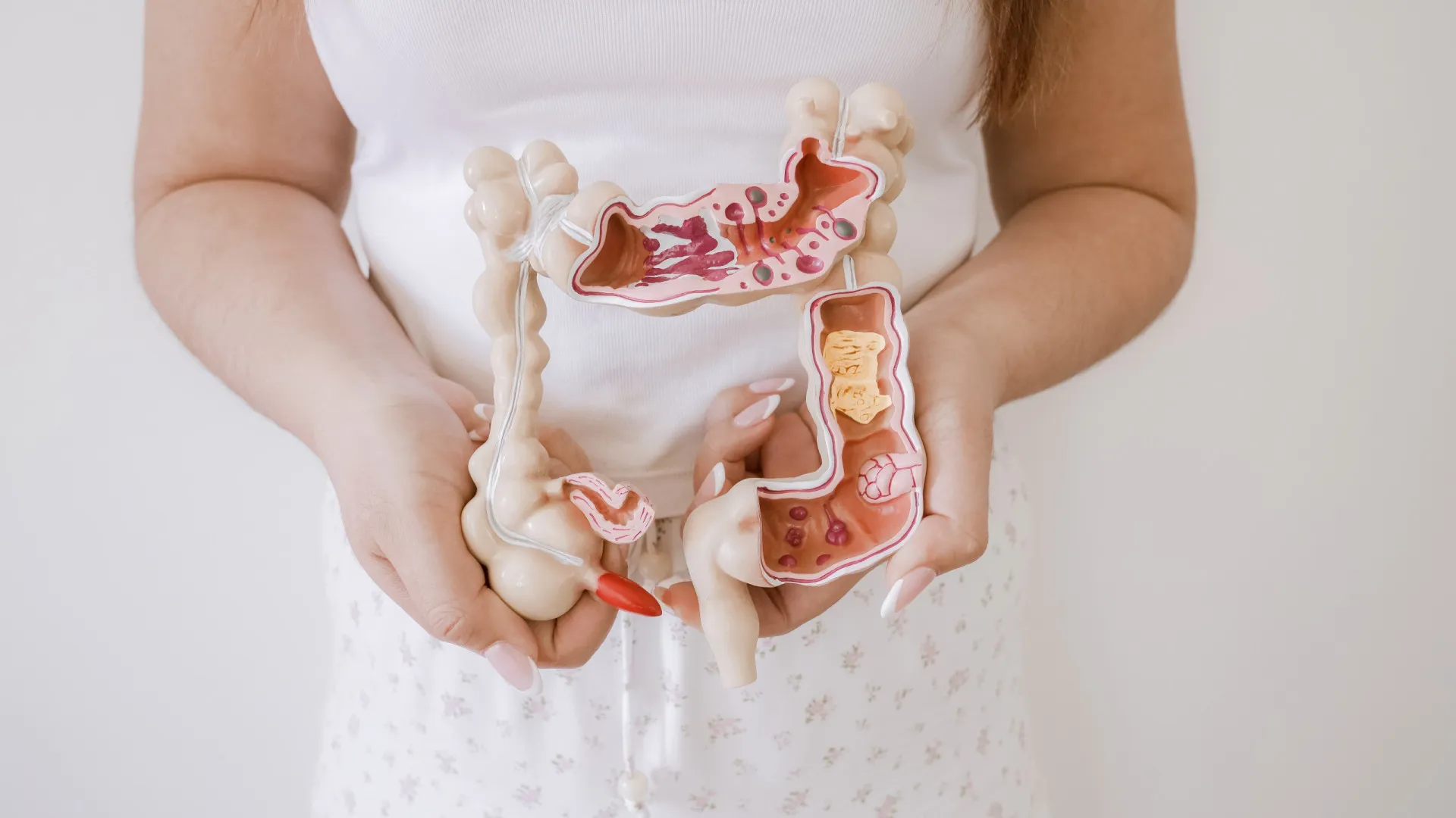 
                    Síndrome do intestino curto: 