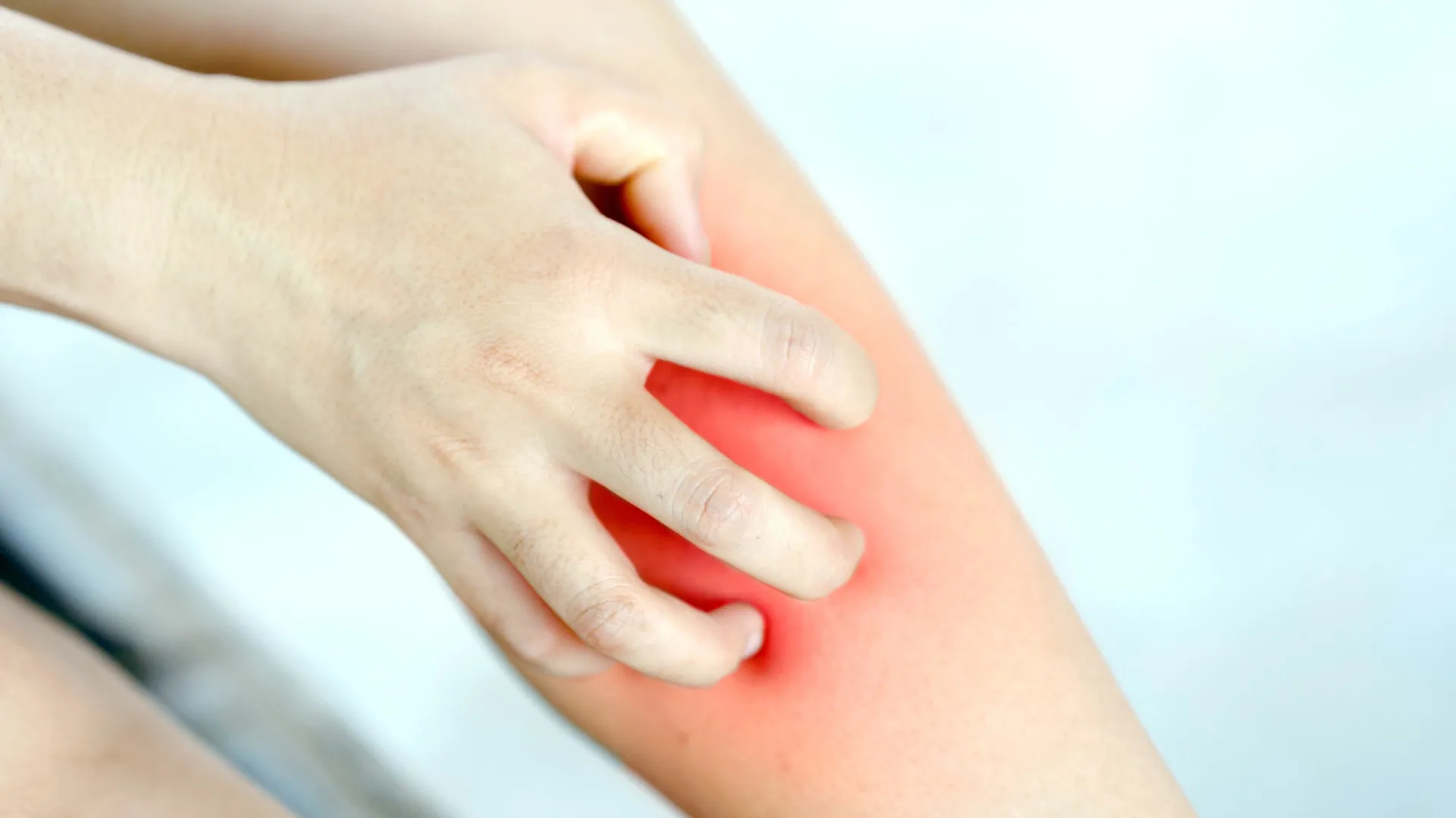 
                    Comichão persistente nas pernas: O sinal que pode indicar problema grave
                