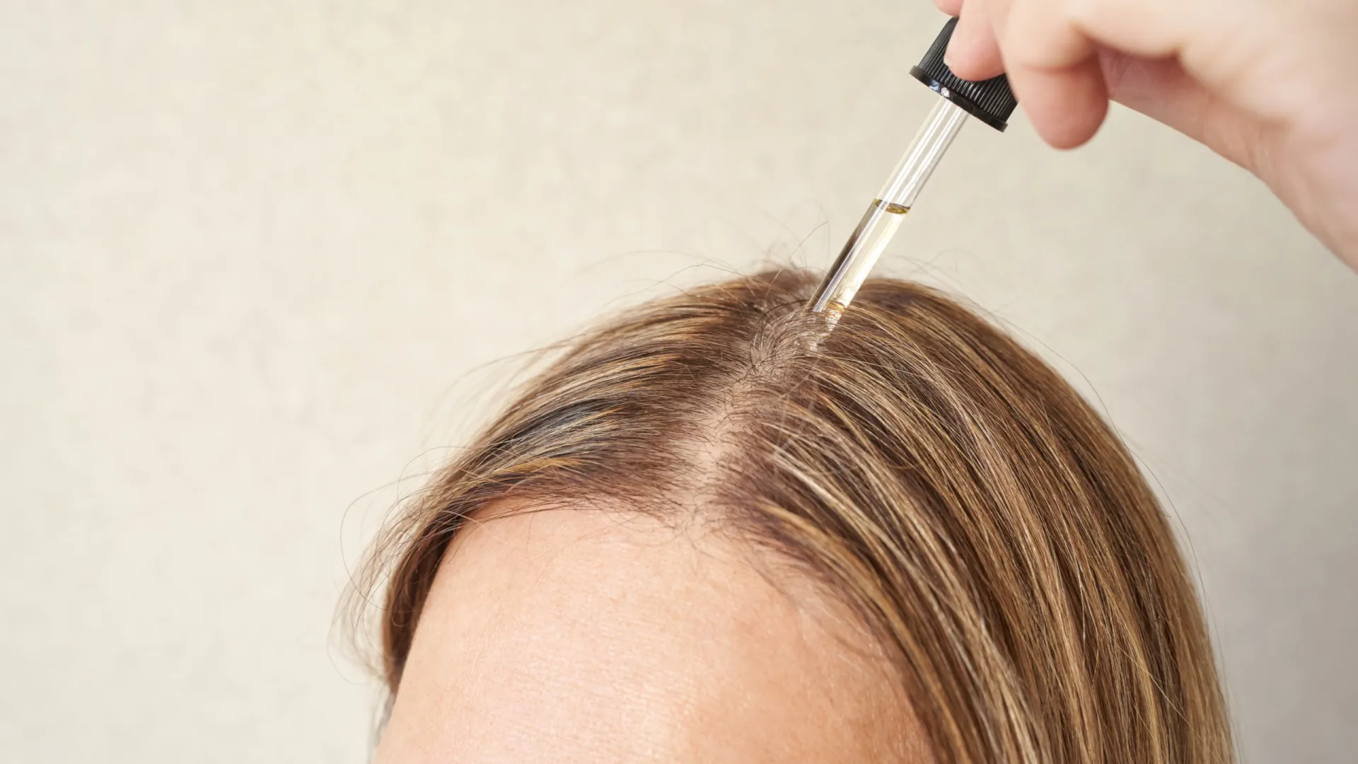 
                    Cuidado! Este produto que ajuda o cabelo a crescer pode deixá-lo oleoso
                