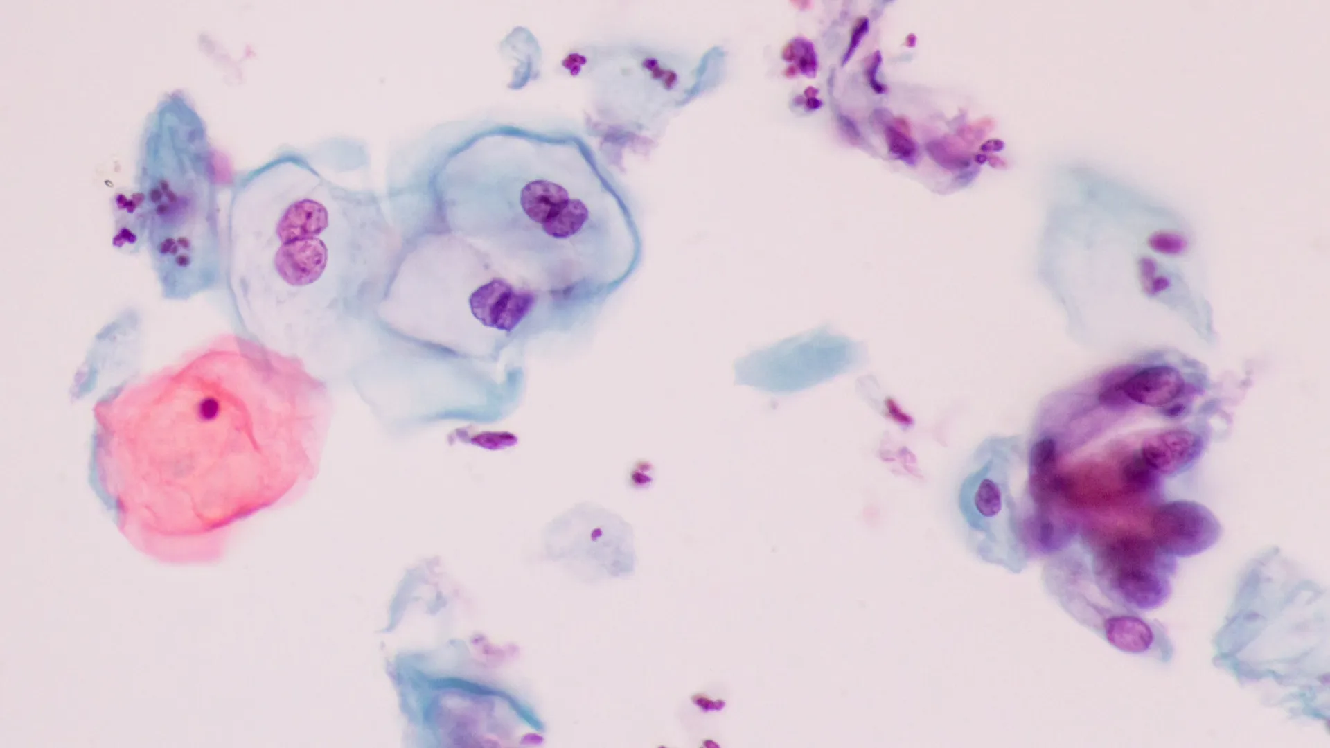 
                    HPV. Que vírus é este, os tipos, a prevenção e como afeta a fertilidade
                