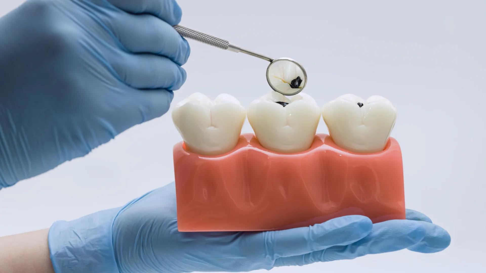 3 (piores) alimentos e bebidas que podem danificar o esmalte dentário