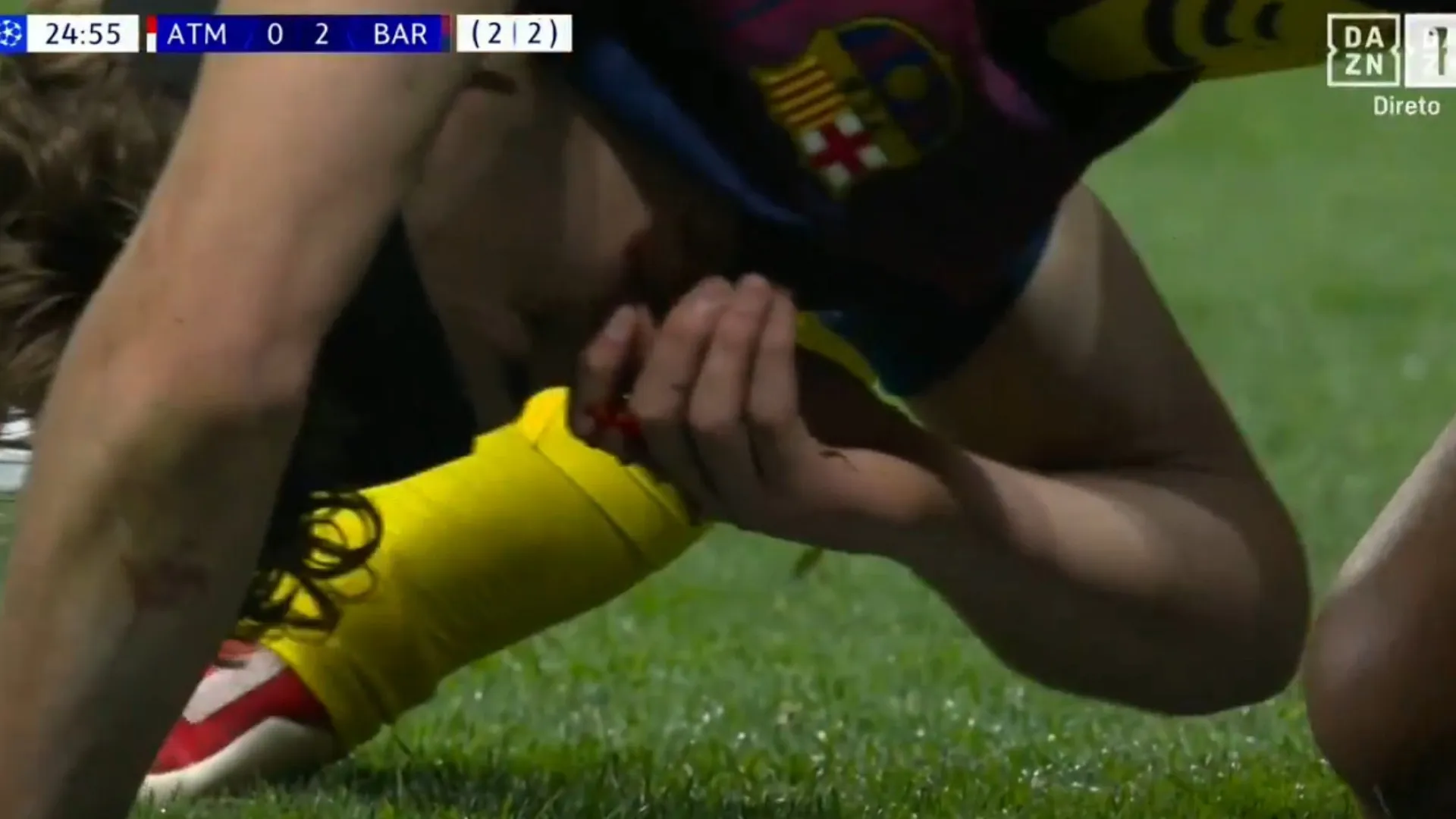 Arrepiante. Fermín dá 'corpo às balas' pelo Barcelona e acaba… em sangue