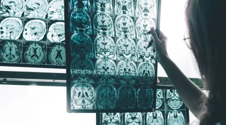 Aveiro. Universidade faz descoberta para diagnosticar e tratar Alzheimer