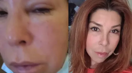 Sónia Costa mostra-se com cara inchada e fãs ficam preocupados