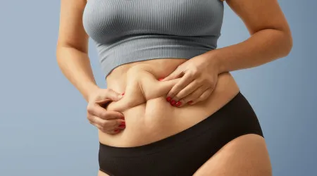 Oito alimentos inflamatórios que aumentam a gordura abdominal
